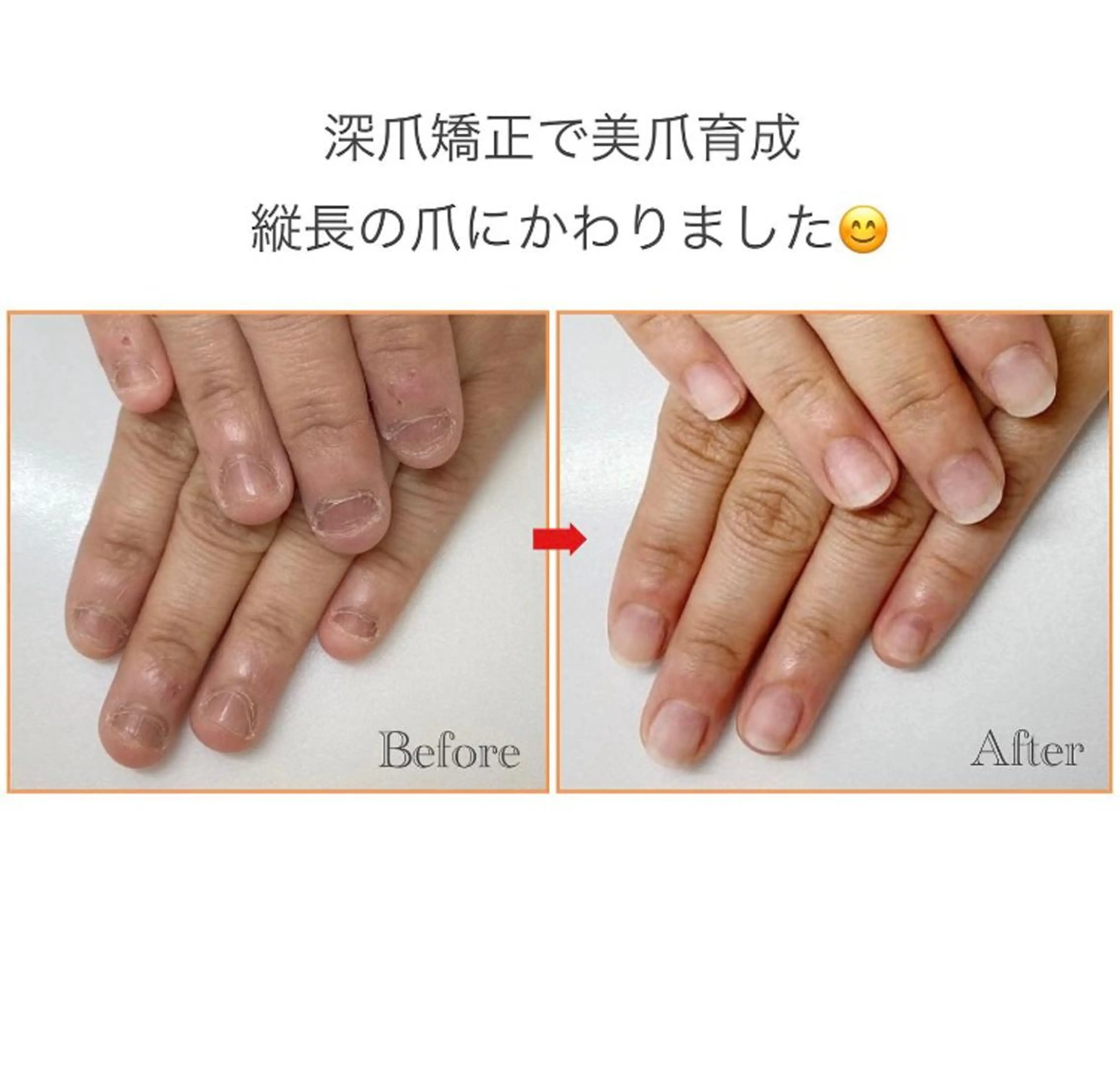 ネイル ネイルサロン アリュームのネイルデザイン