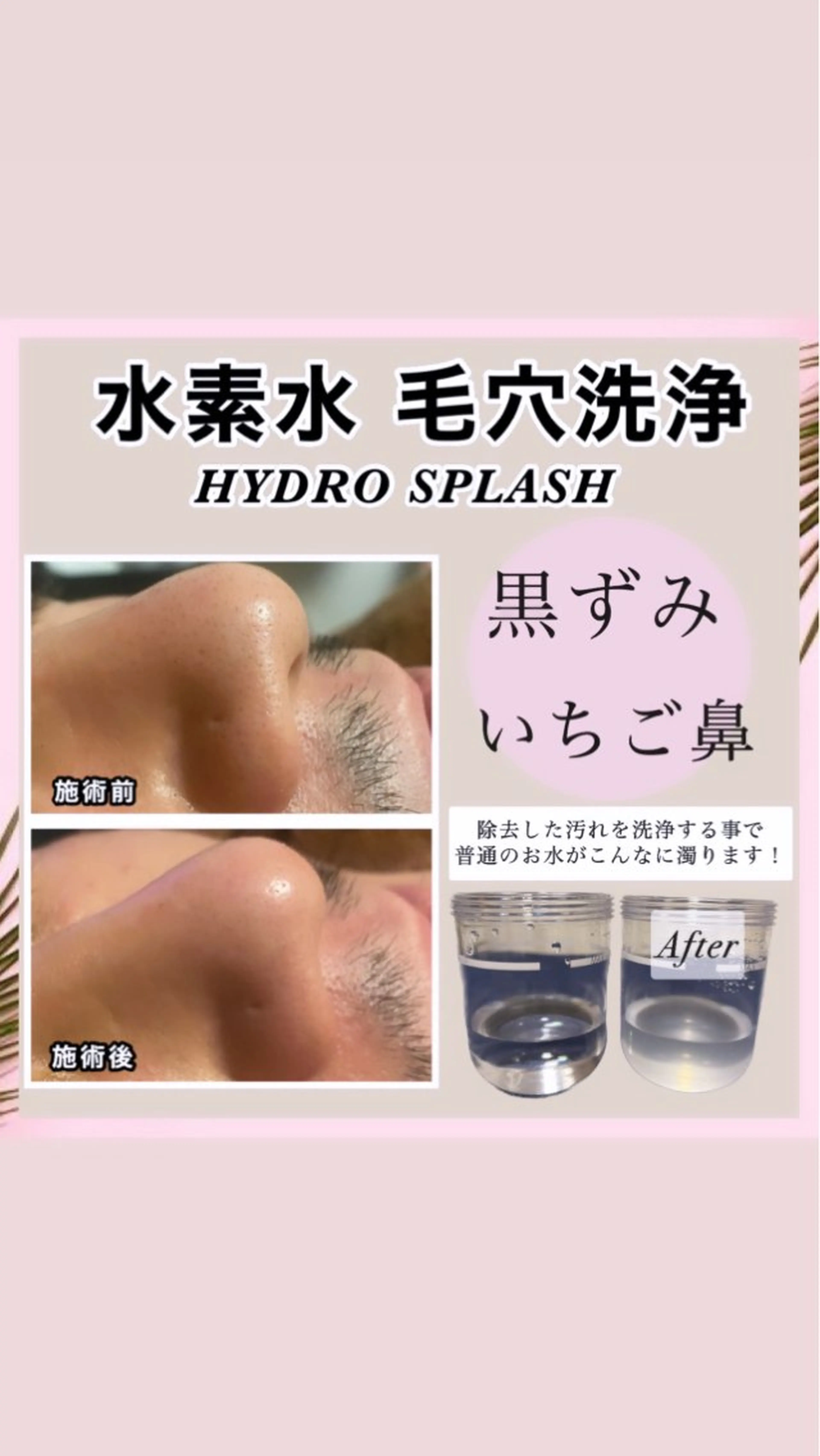 その他 肌質改善/痩身専門店 🌴のその他イメージ