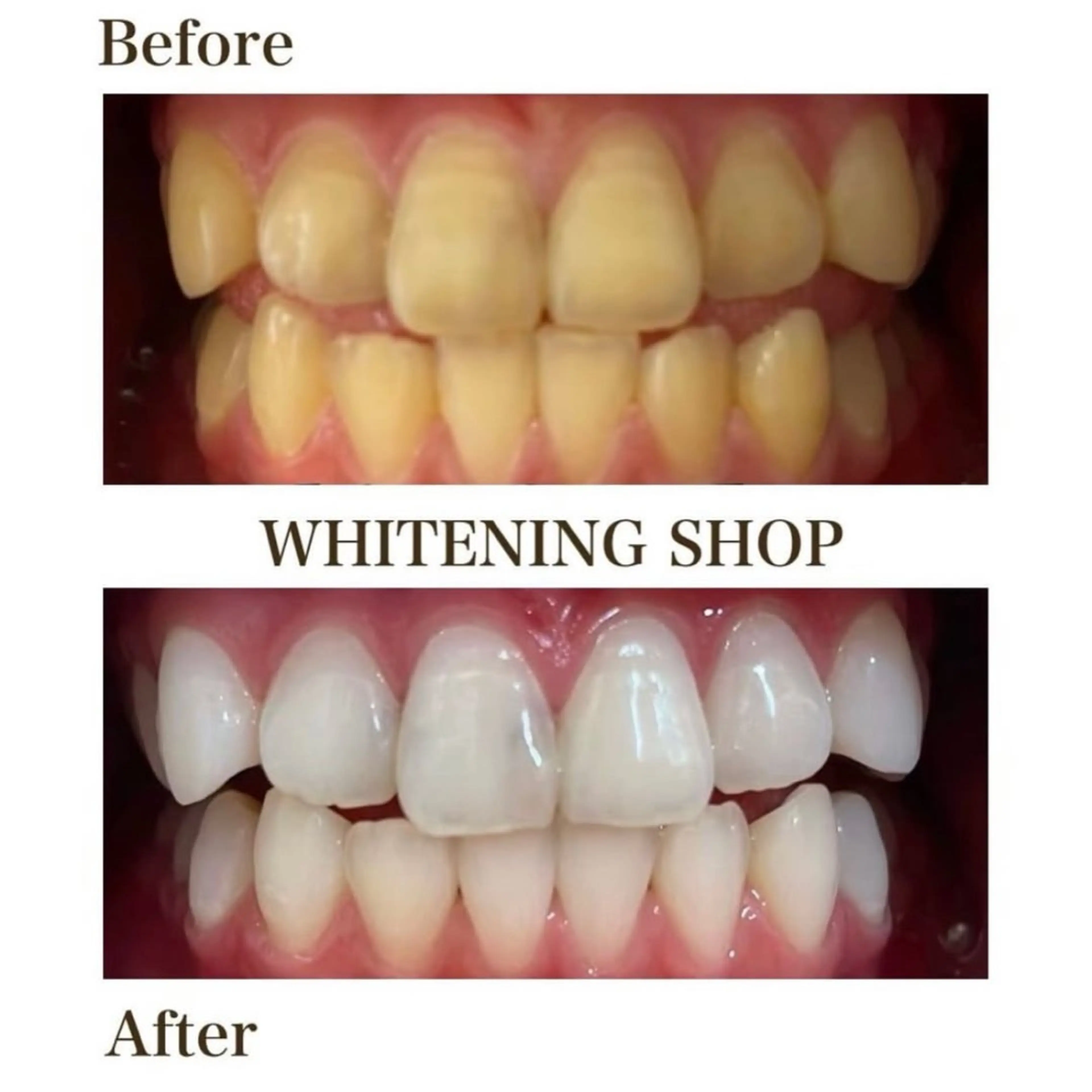 ホワイトニング ショップ伊丹店のその他イメージ