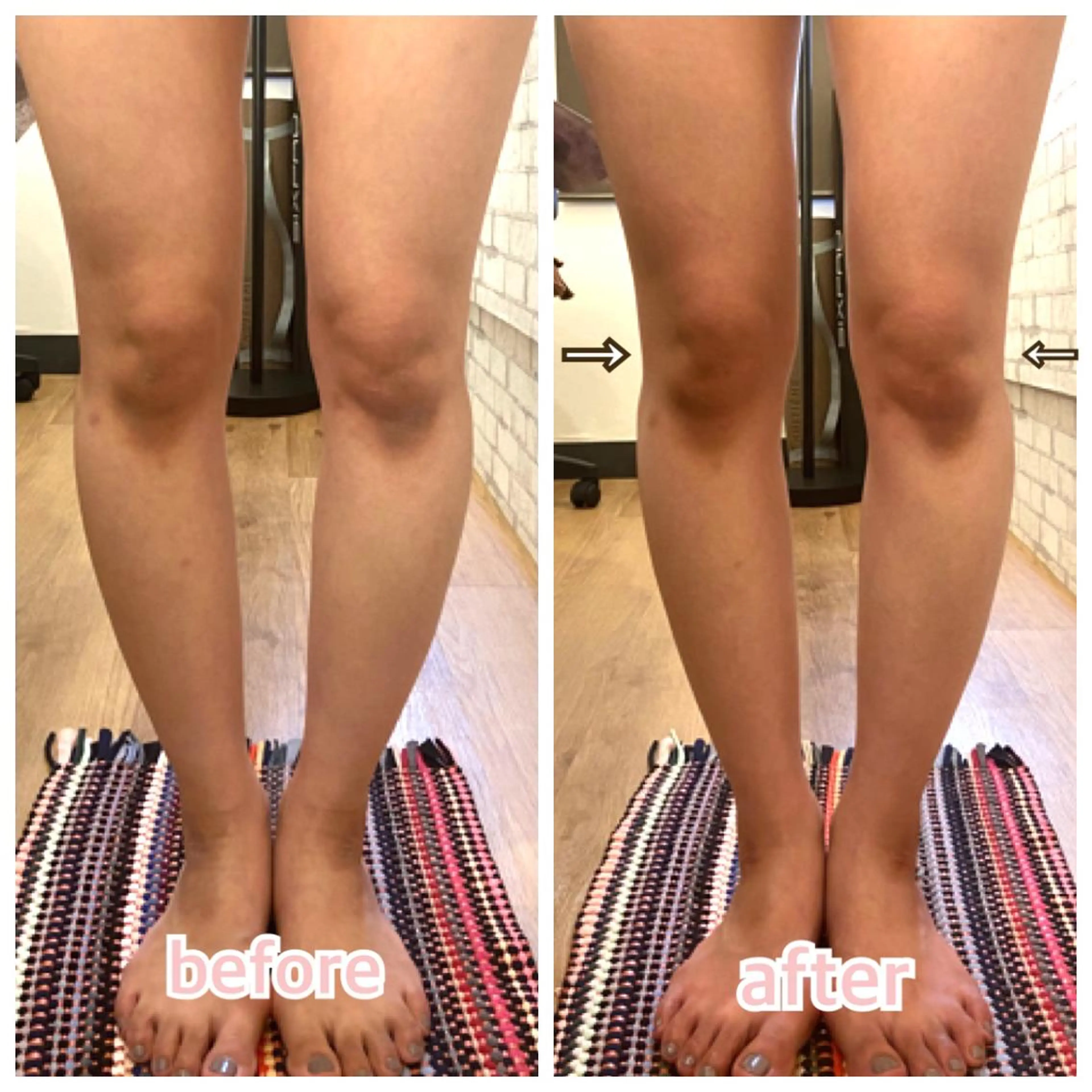 【小顔矯正】 salonaceのエステ・リラクイメージ