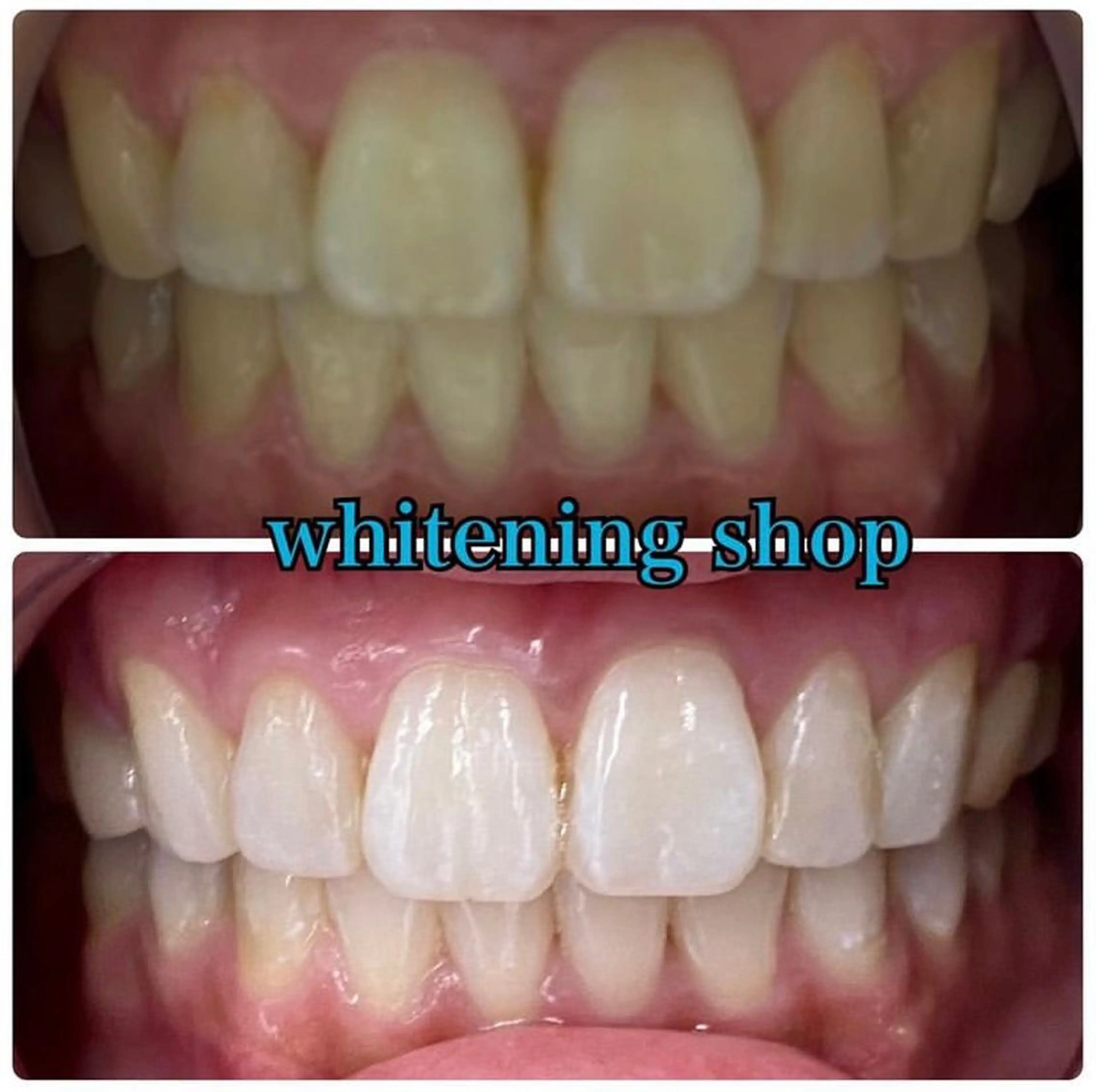 ホワイトニング ショップ吉祥寺店のエステ・リラクイメージ