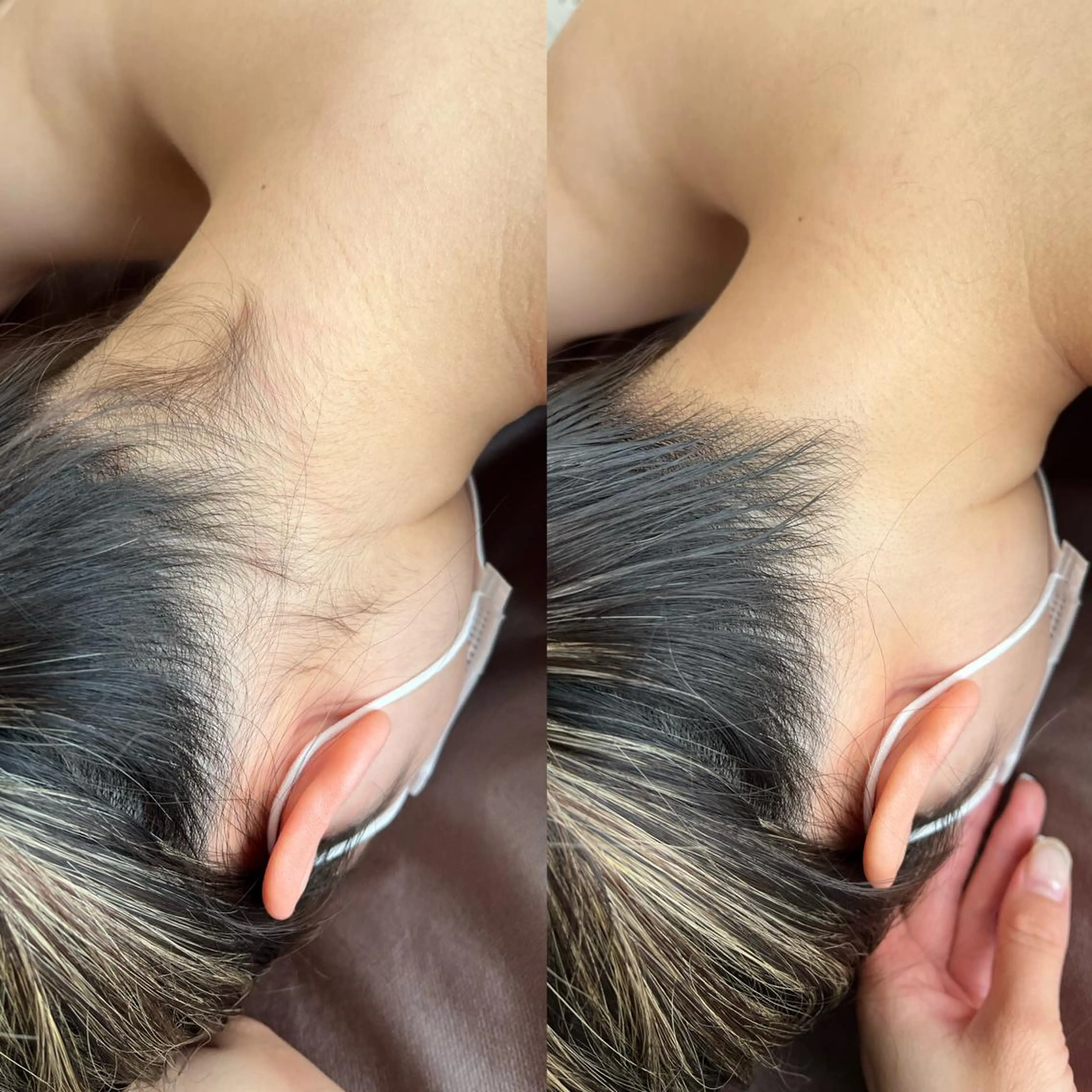 毛穴/シミ肝斑/脱毛 横山梨里のエステ・リラクイメージ