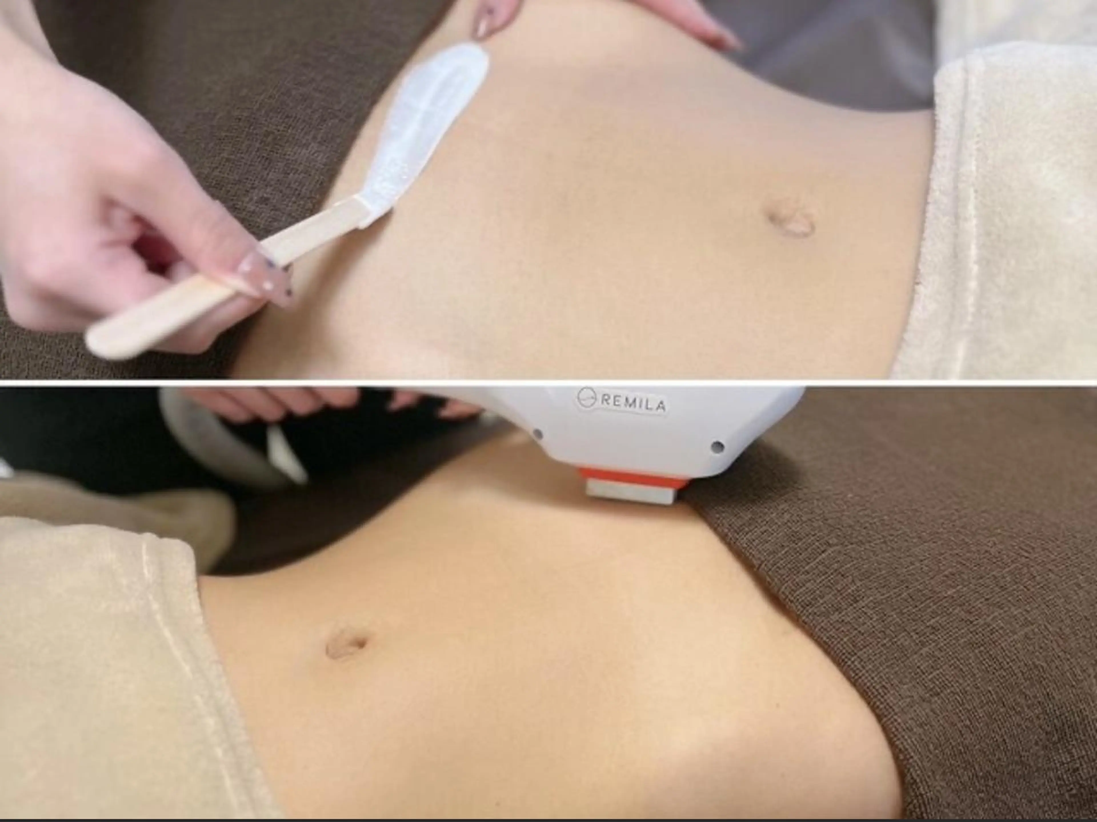 メンズ キッズ 脱毛 Epina 千葉店 【エピナ】のエステ・リラクイメージ