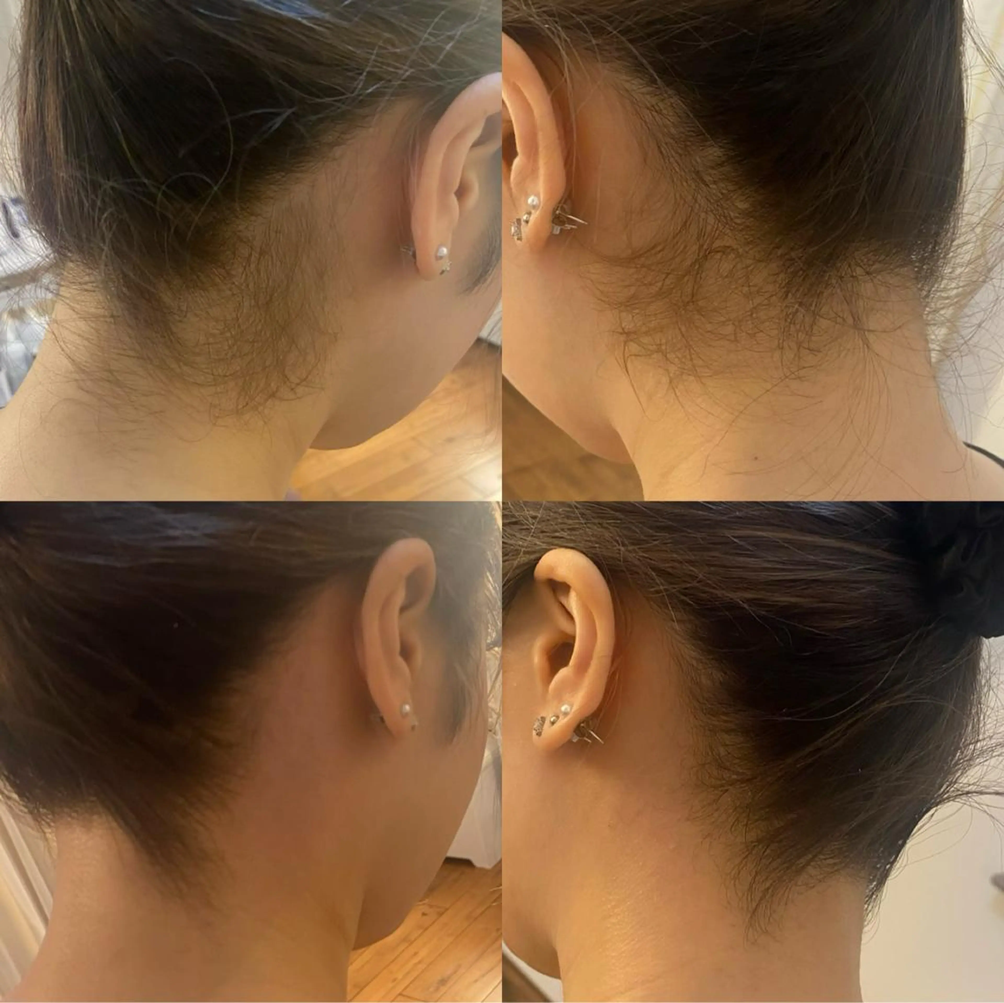 脱毛 BELCIA福岡店　récolte de BELCIA（レコルトデベルシア）所属・BELCIA福岡店 レコルトデベルシアのエステ・リラクイメージ