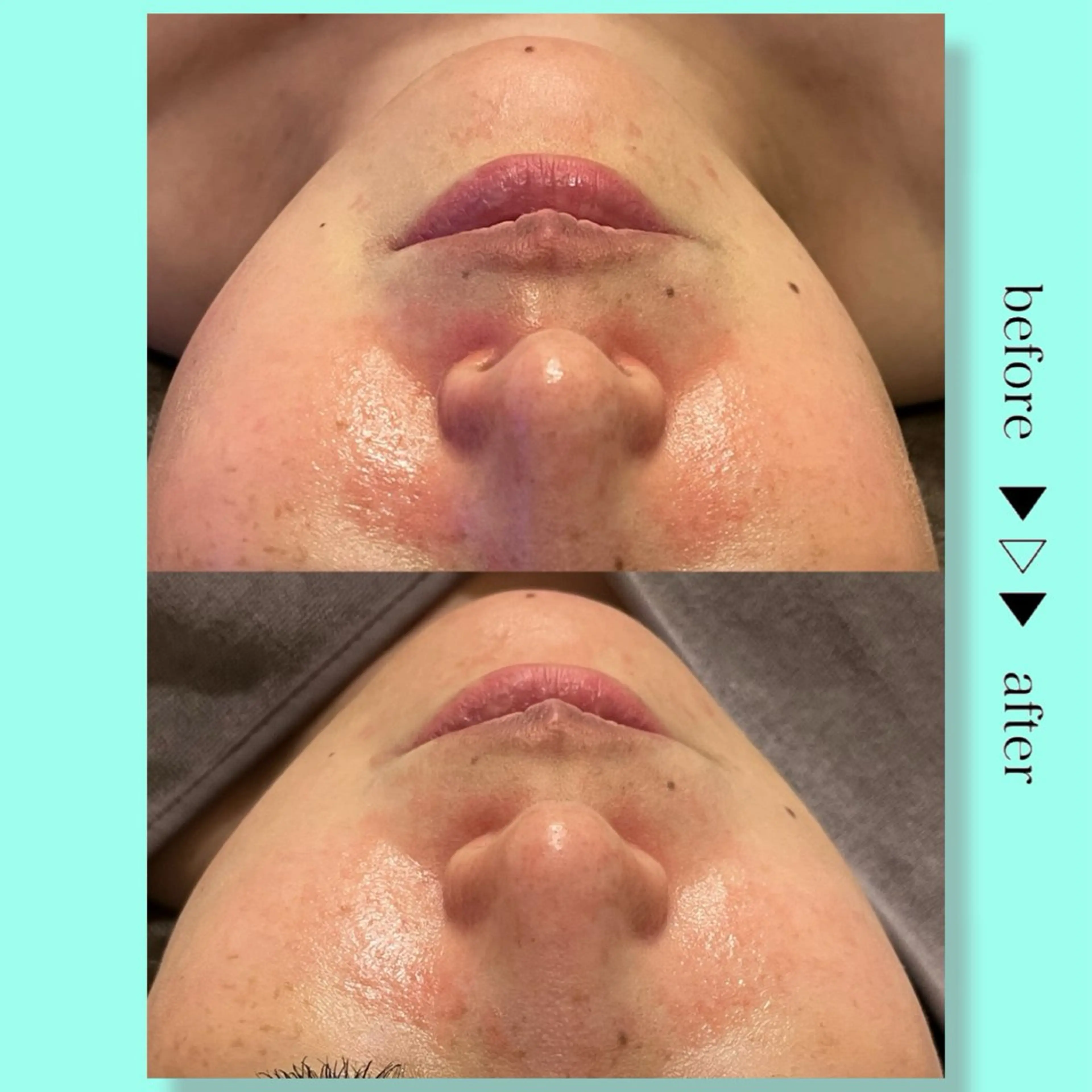 小顔コルギ ☆表参道/外苑前のエステ・リラクイメージ