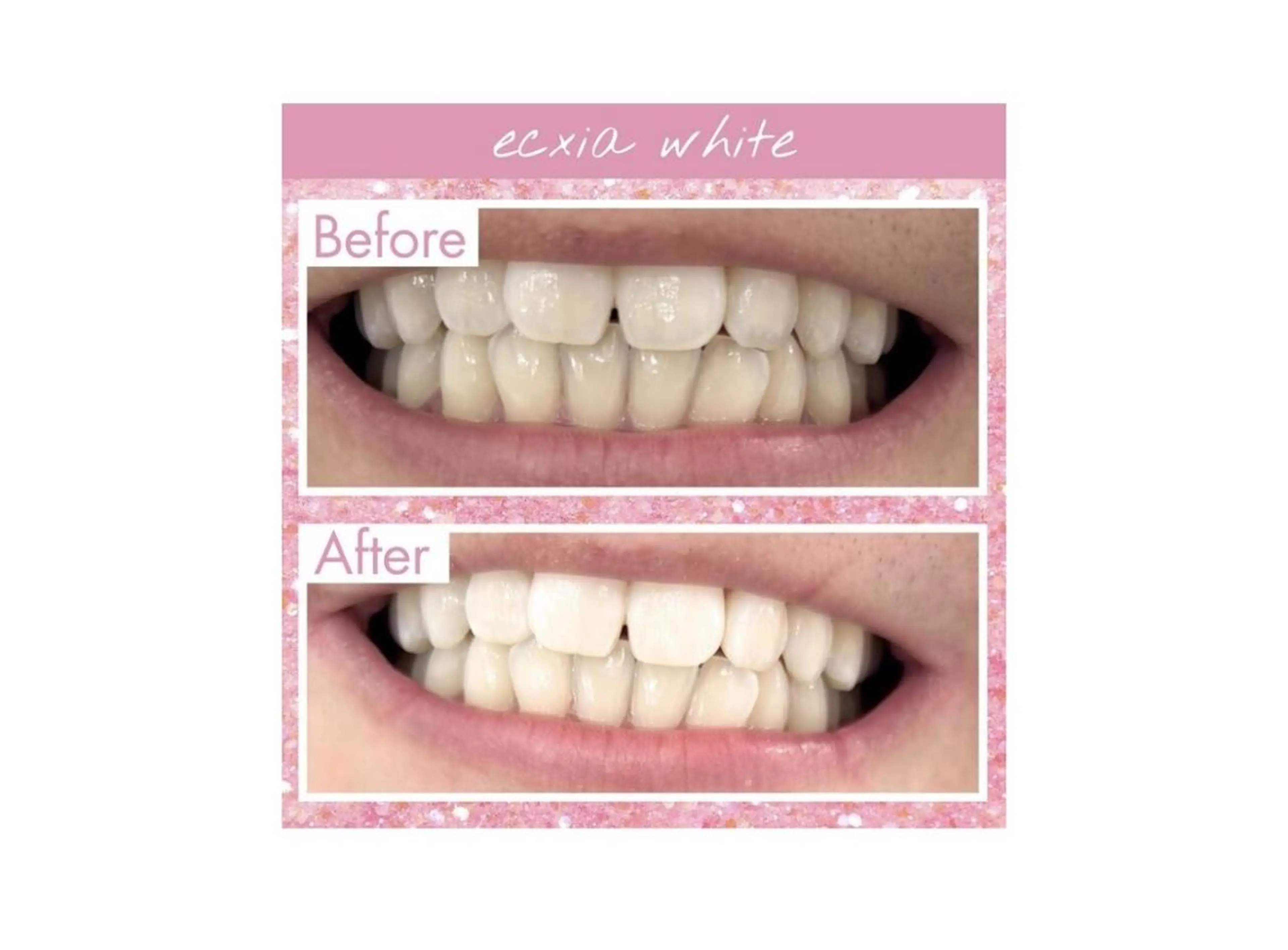 その他 セルフホワイトニング エクシア大阪梅田店のその他イメージ