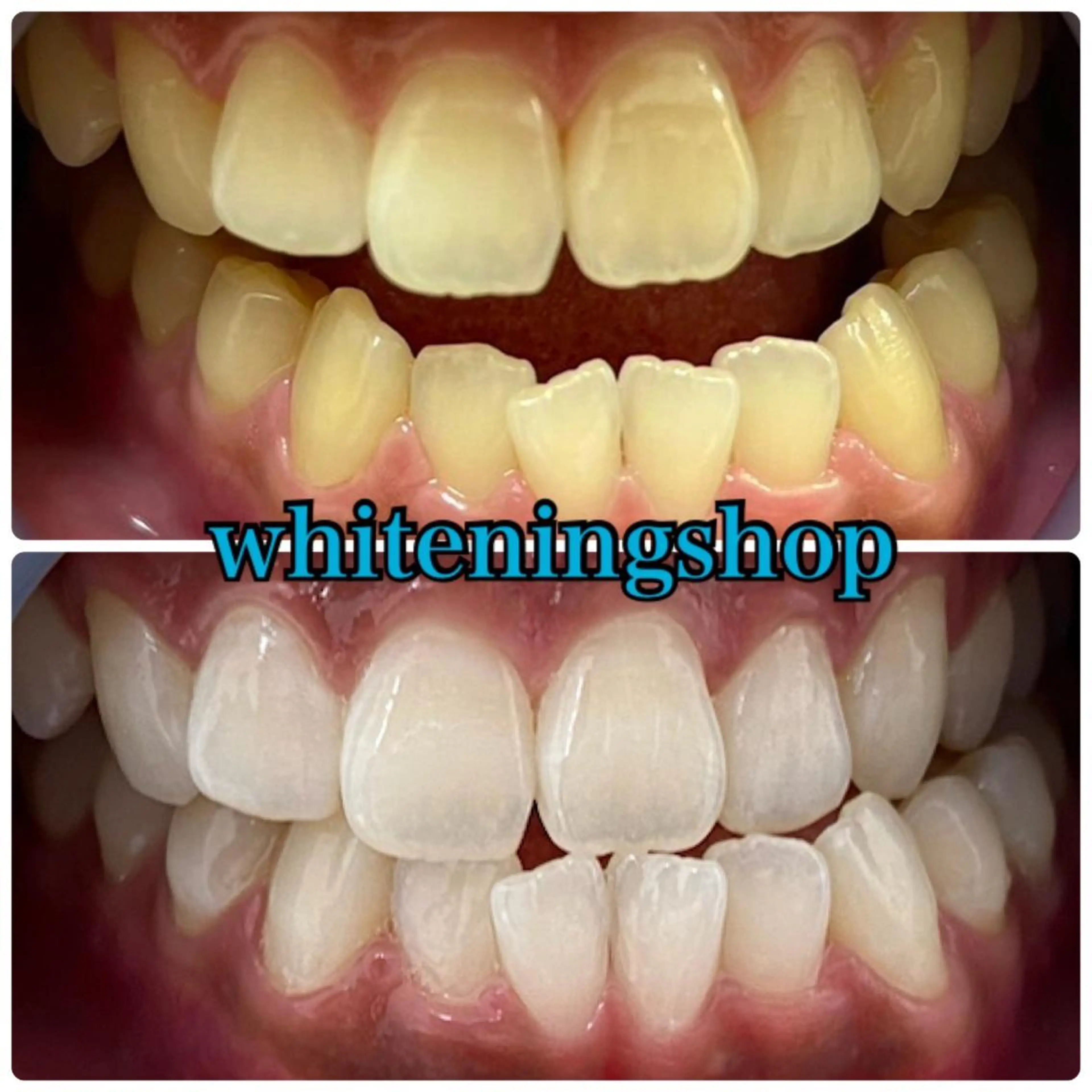 ホワイトニング ショップ吉祥寺店のエステ・リラクイメージ