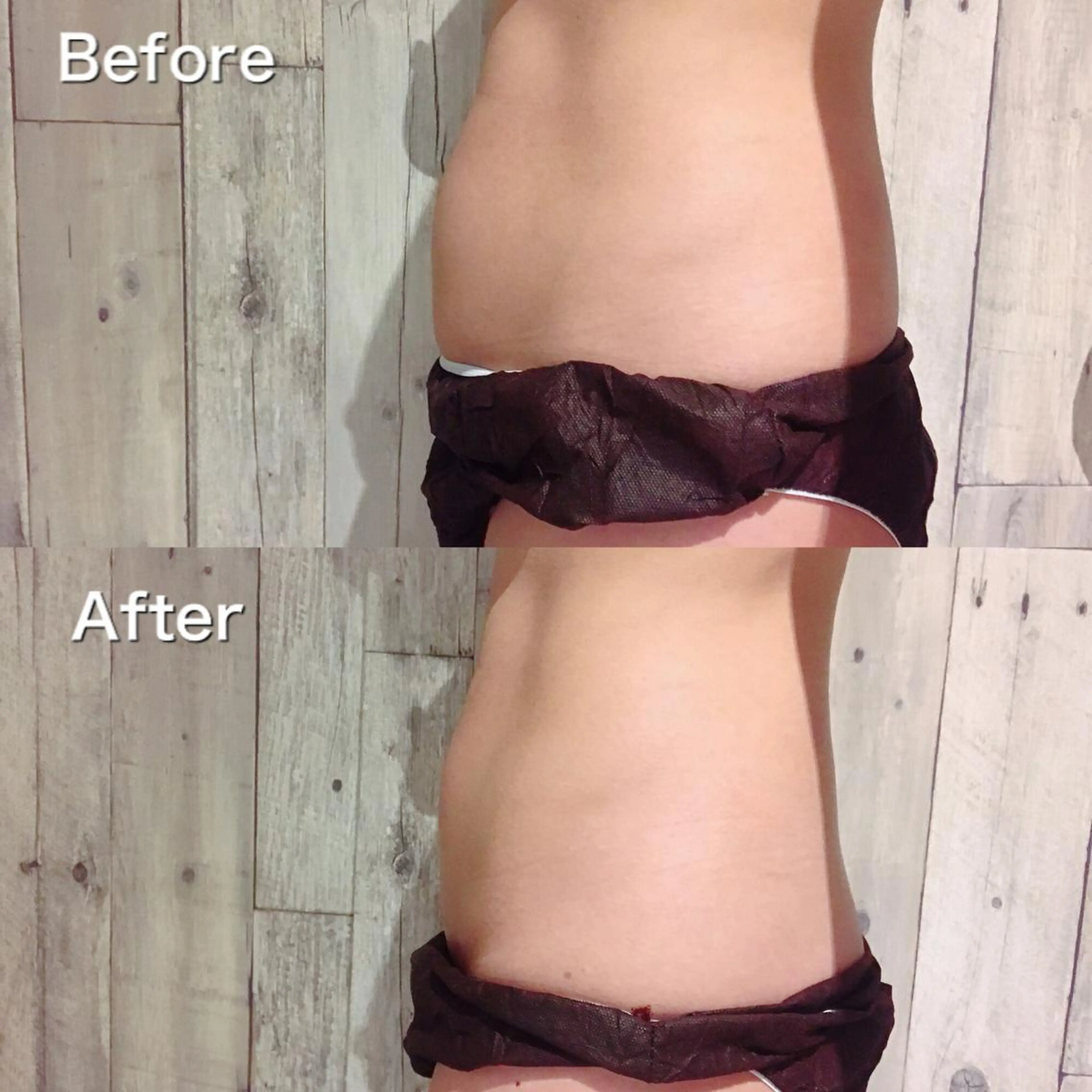 結果重視！ウエスト痩身コースの写真