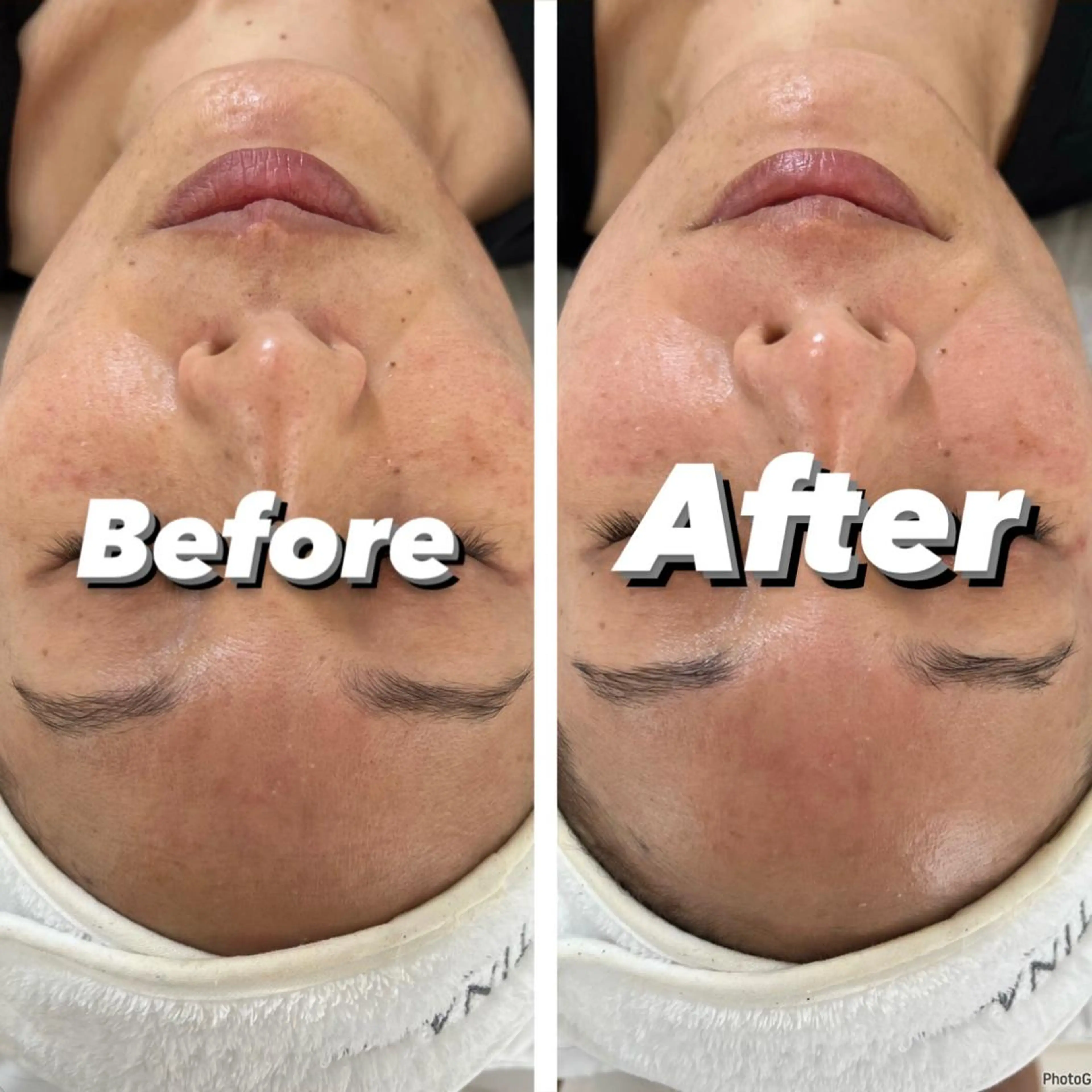 エステ HBL💖 Sakuraの眉毛・アイブロウイメージ