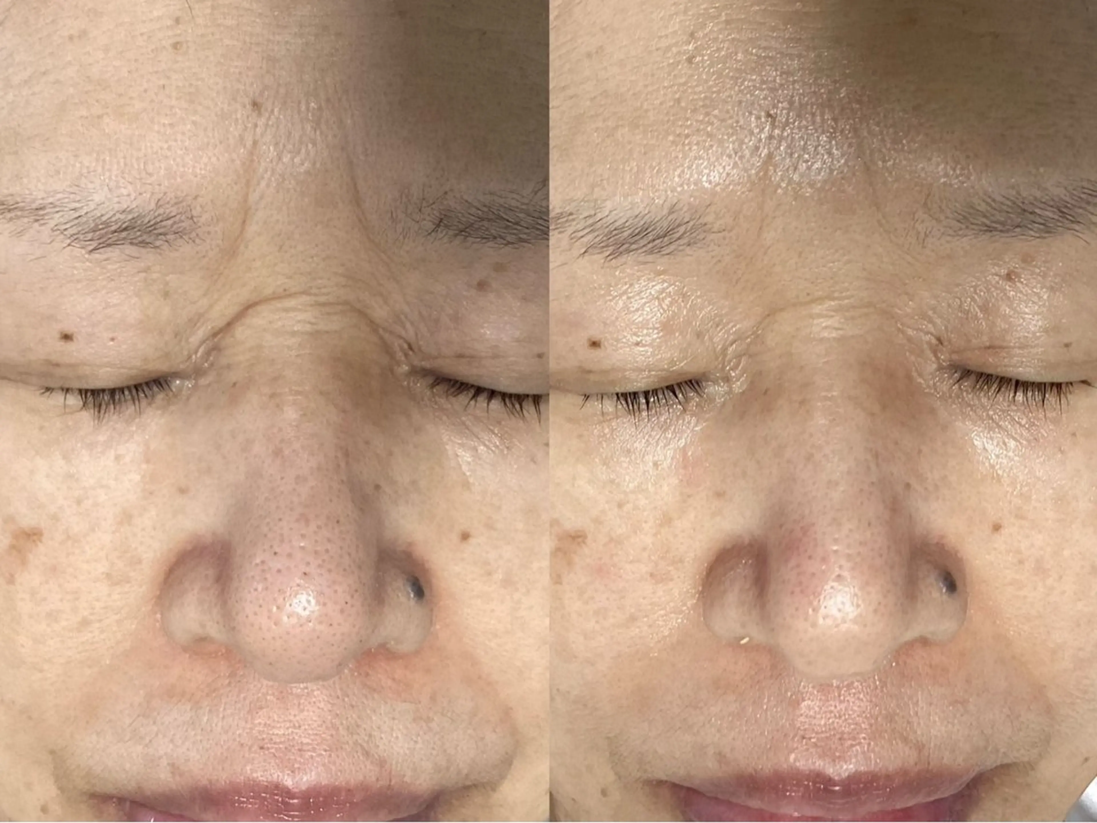 エステ リラク ホワイティアビシェル ウラワ　白澤奇のエステ・リラクイメージ