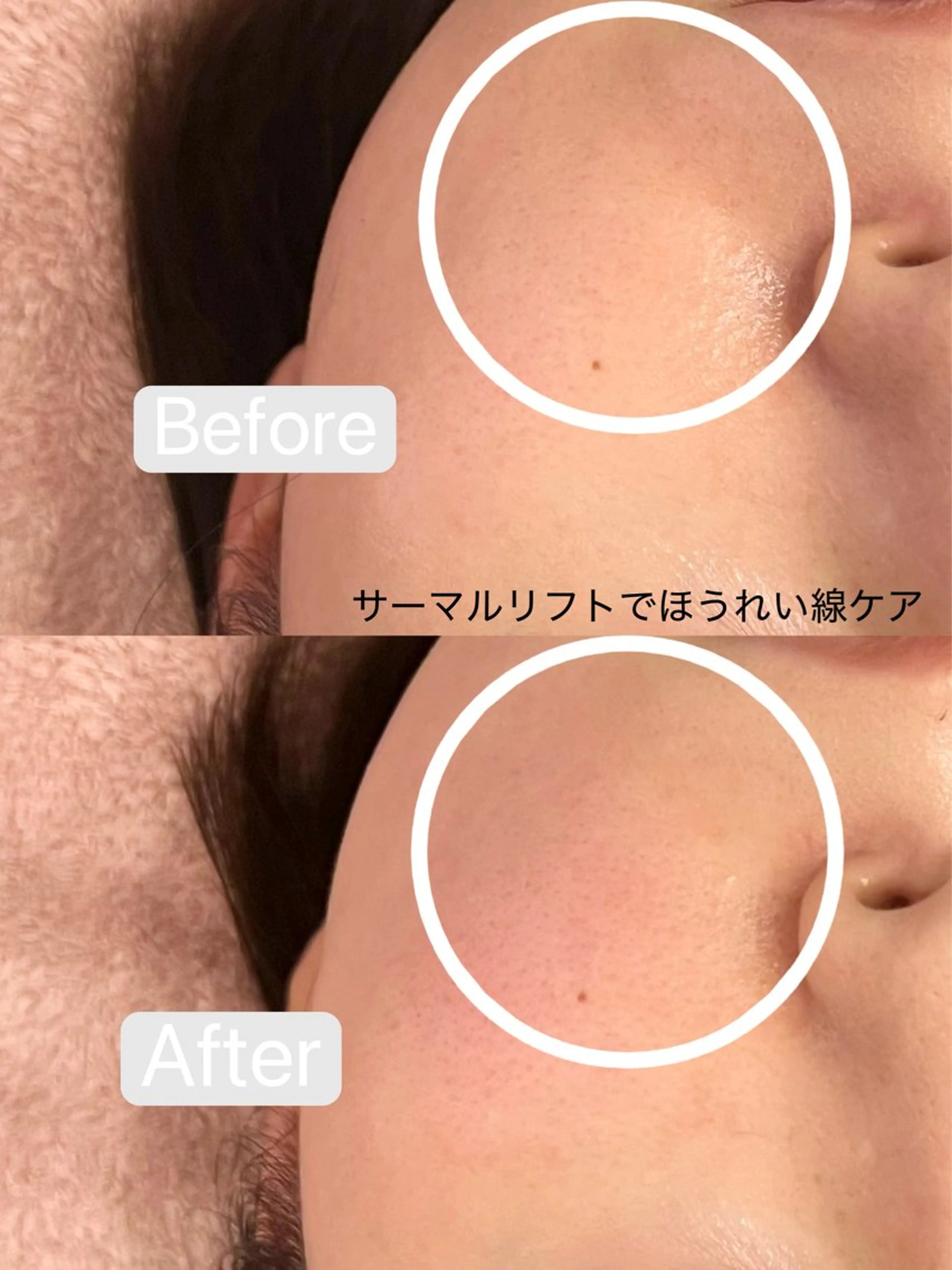 エステ 小顔&毛穴・肌質改善 LINDA西宮 AIのエステ・リラクイメージ