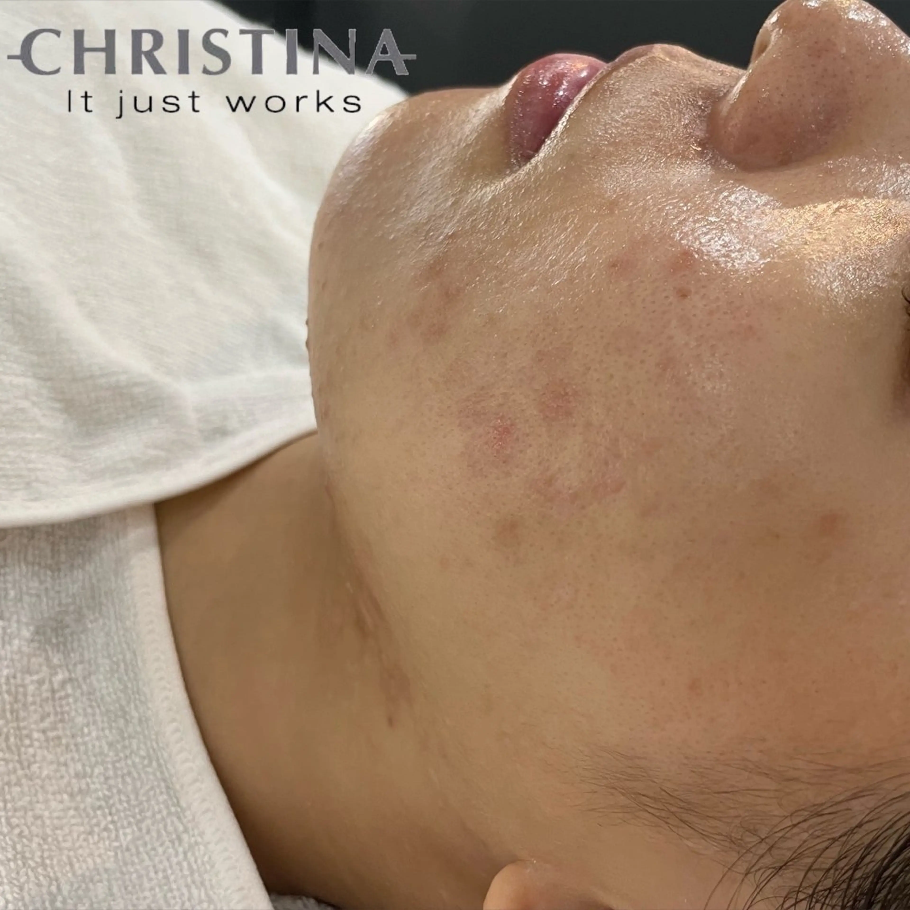 エステ lazo MIYOの眉毛・アイブロウイメージ