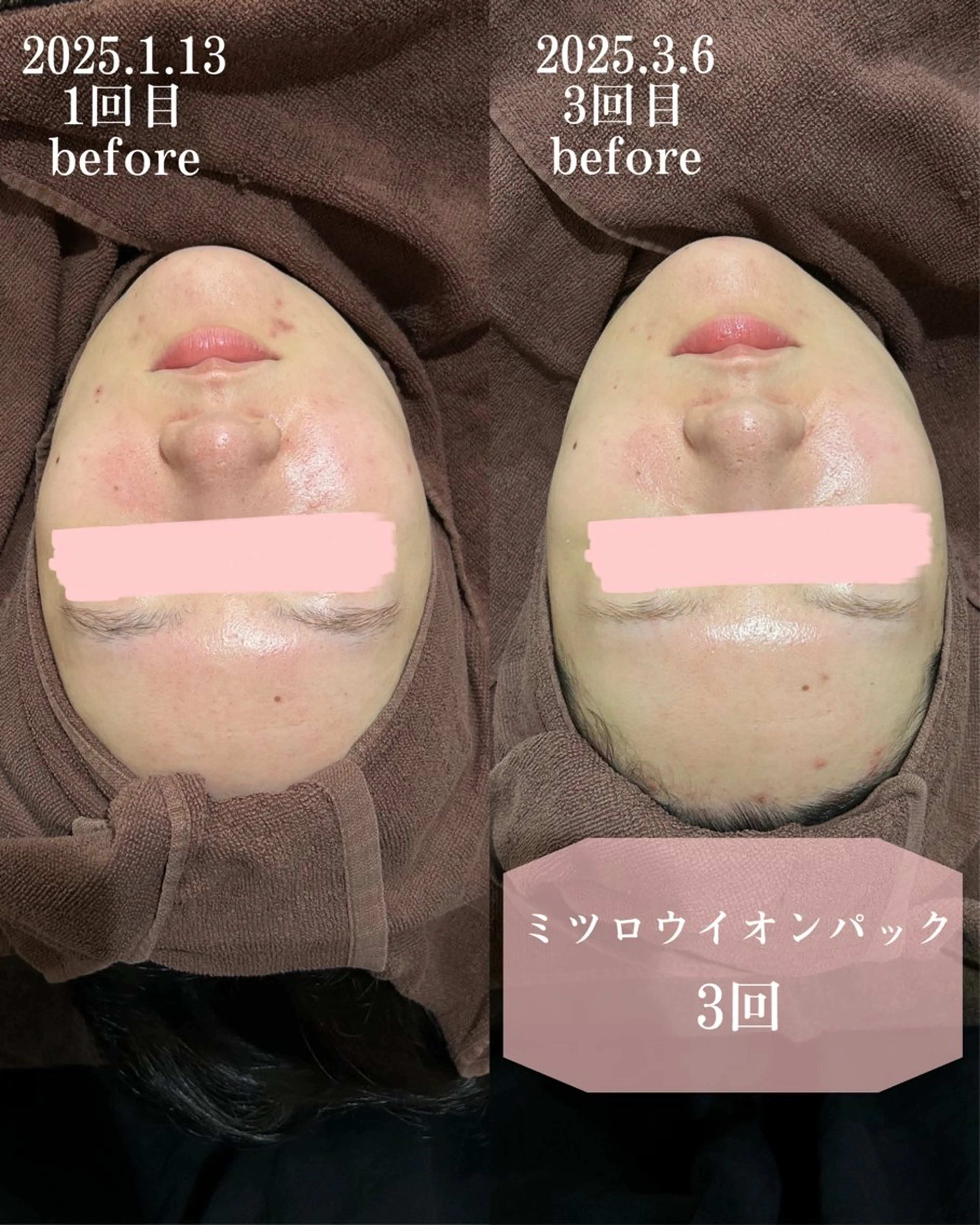 エステ まつげ/整体/にきび ・アトピー専門サロンのマツエク・マツパデザイン