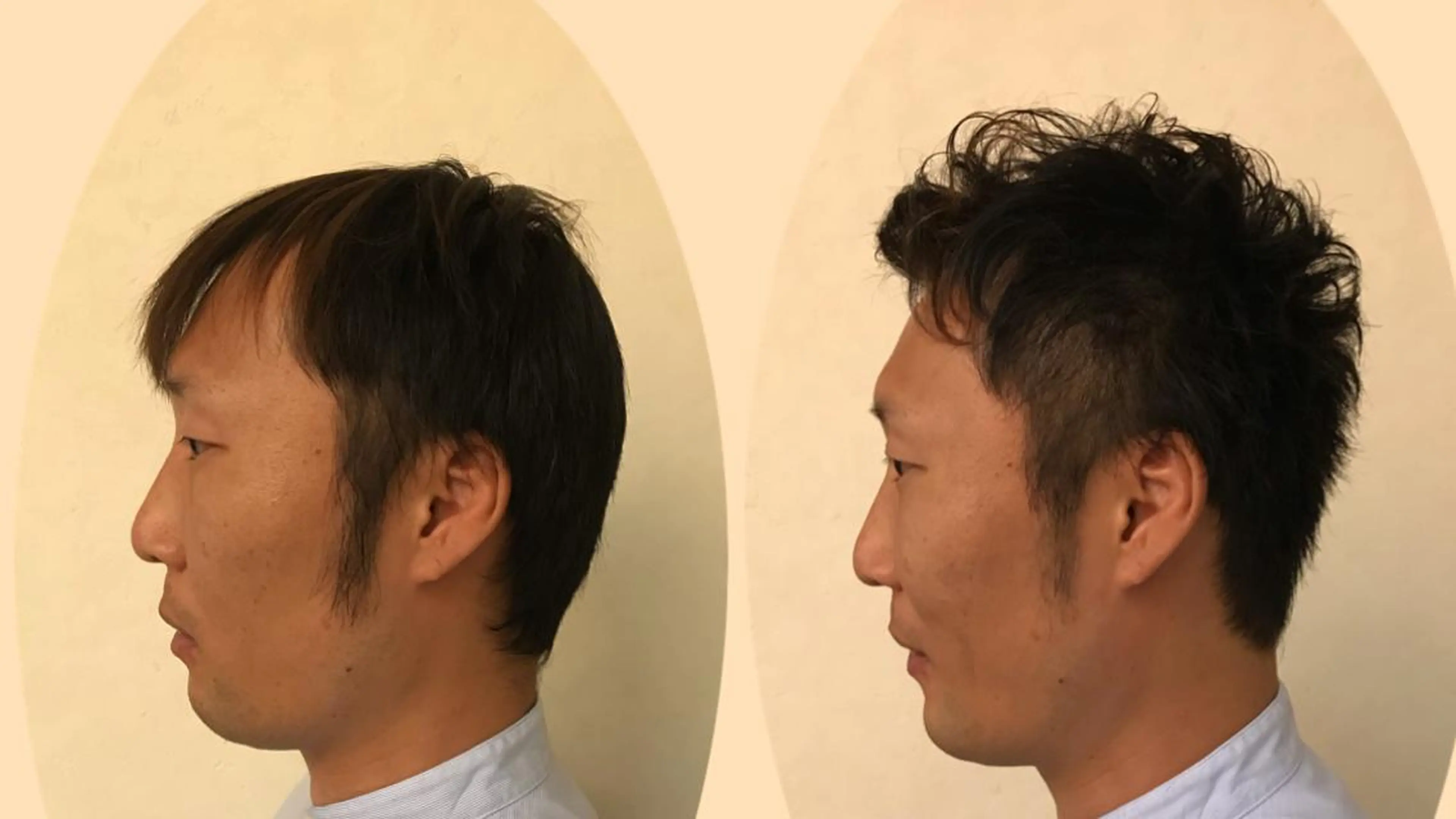 ショート パーマ YouTube 出演募集のその他イメージ