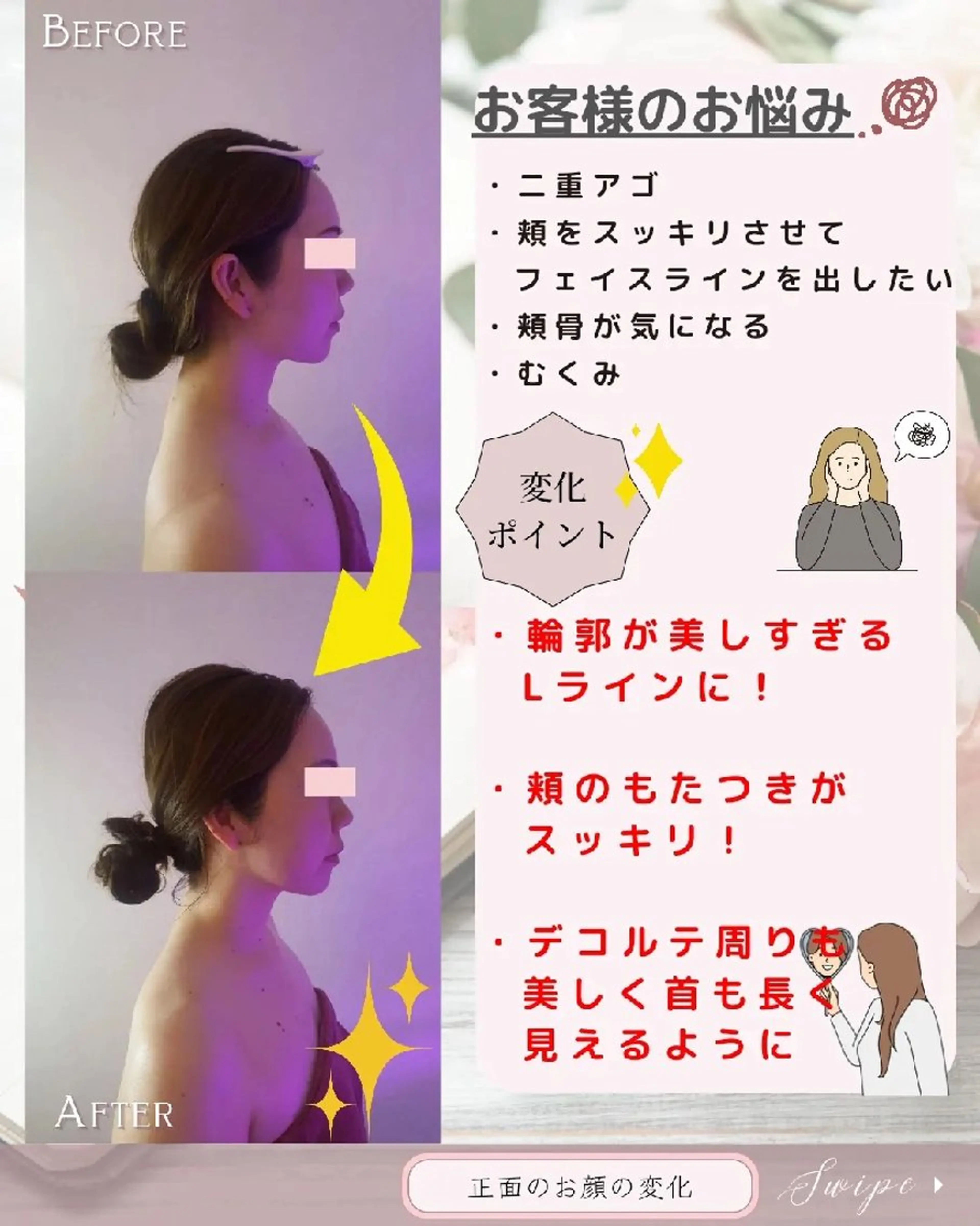 痩身ハーブピーリング 筋膜リリース☆B&Hのエステ・リラクイメージ