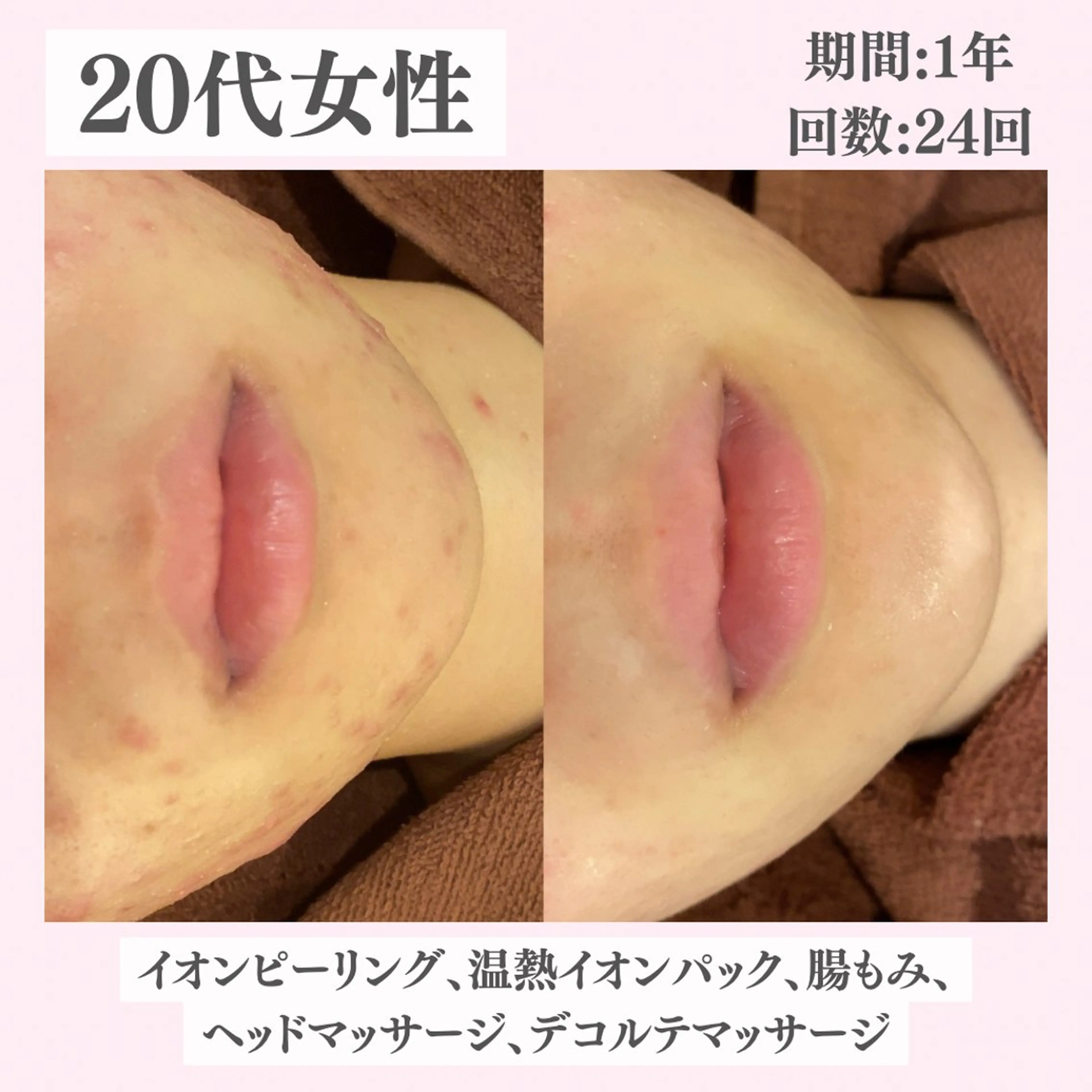 エステ リラク ニキビ・肌質改善専門 ♡人生が変わるサロンのエステ・リラクイメージ