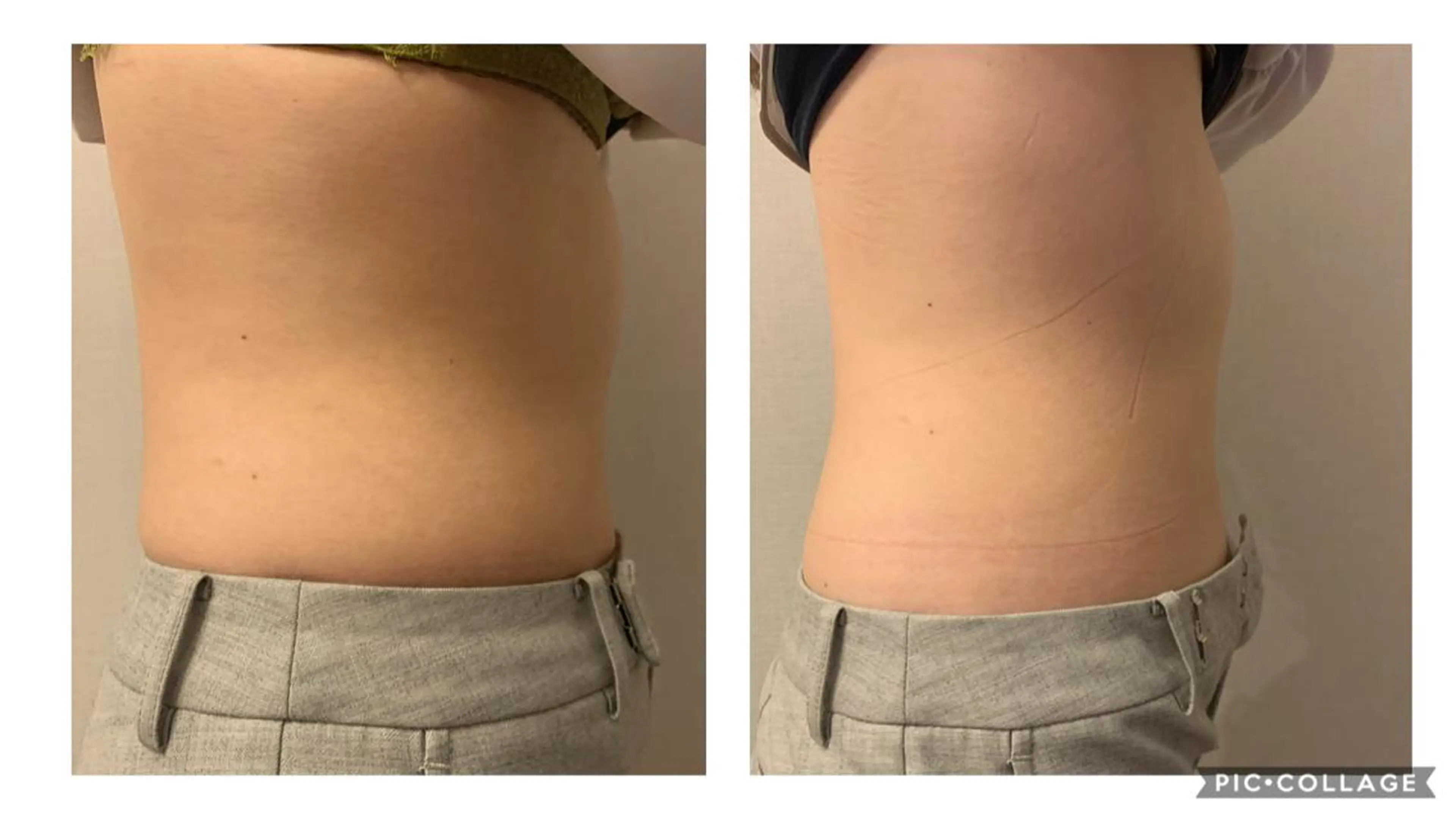 POLA大阪堀江店所属・POLA大阪堀江店 小顔エステのエステ・リラクイメージ