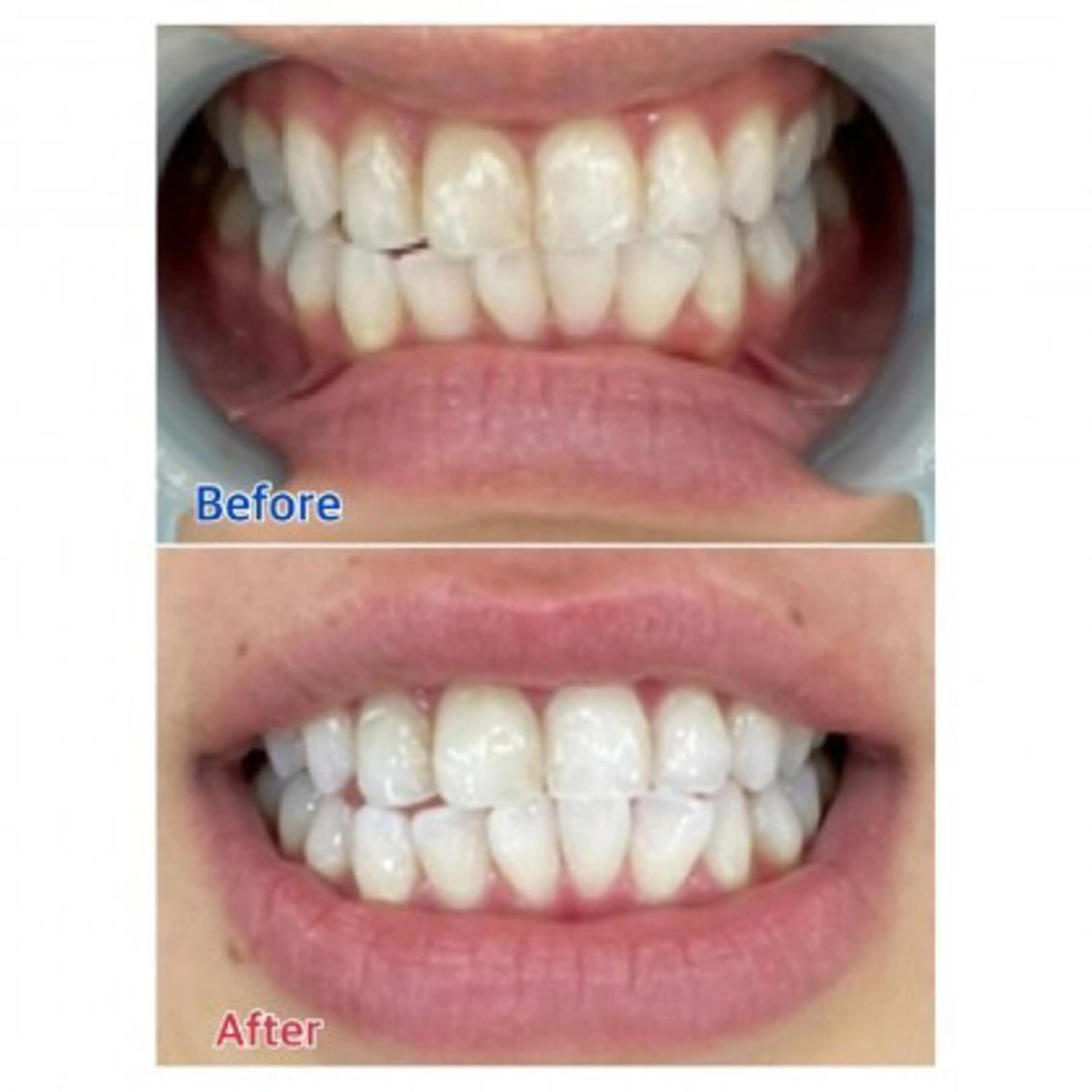 Ｍ渋谷 ホワイトニングのエステ・リラクイメージ