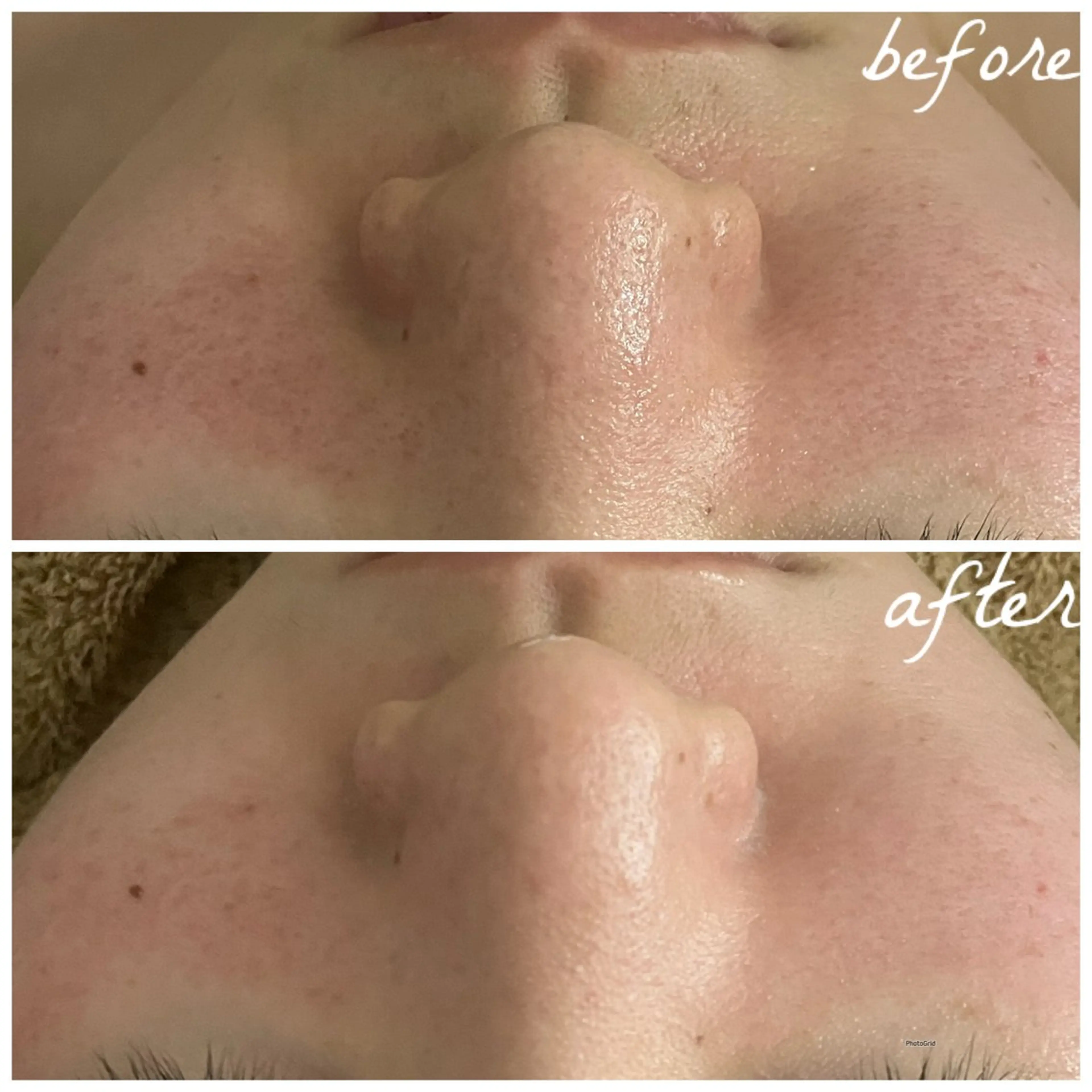 メンズ エステ メナード岐阜茜部 杉浦のエステ・リラクイメージ