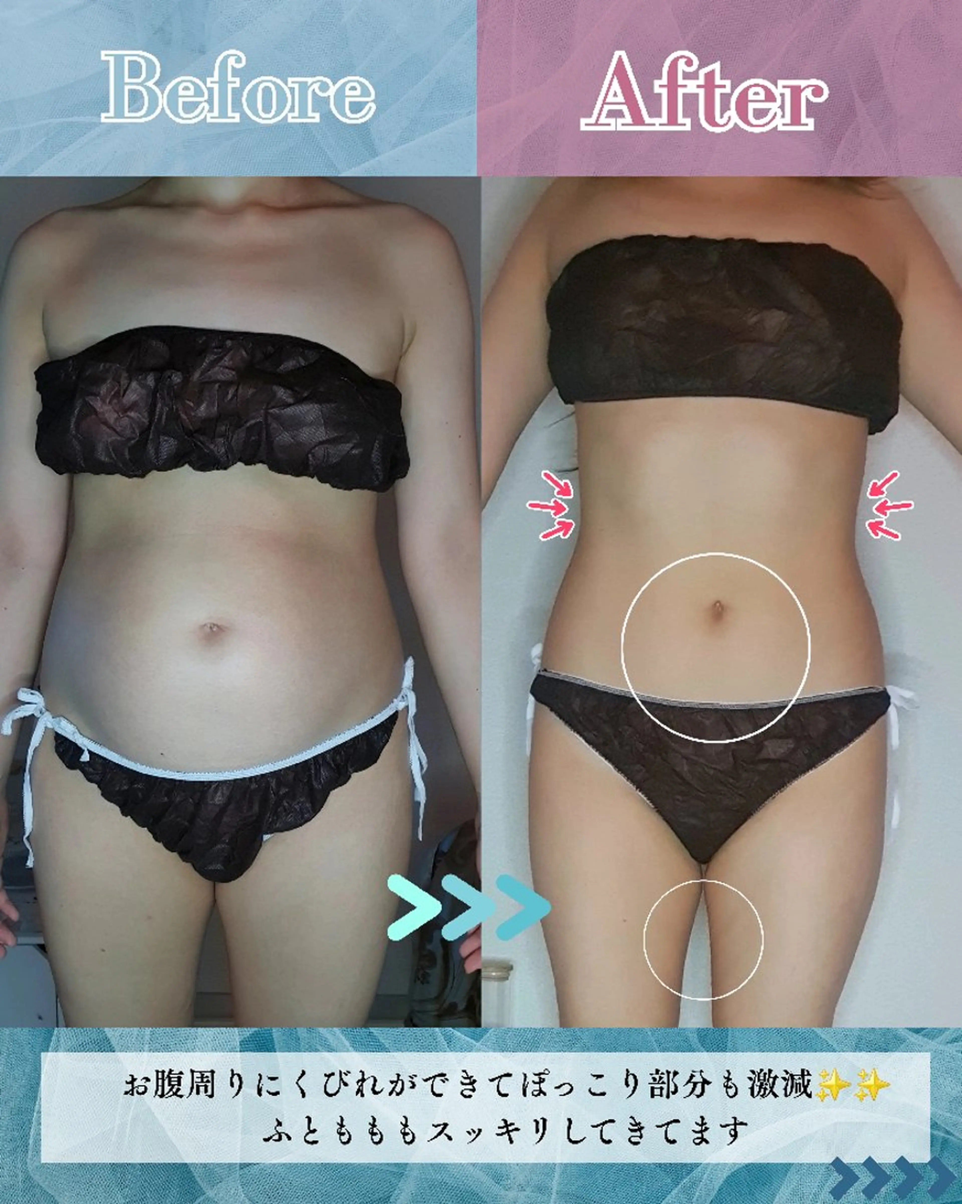 痩身ハーブピーリング 筋膜リリース☆B&Hのエステ・リラクイメージ