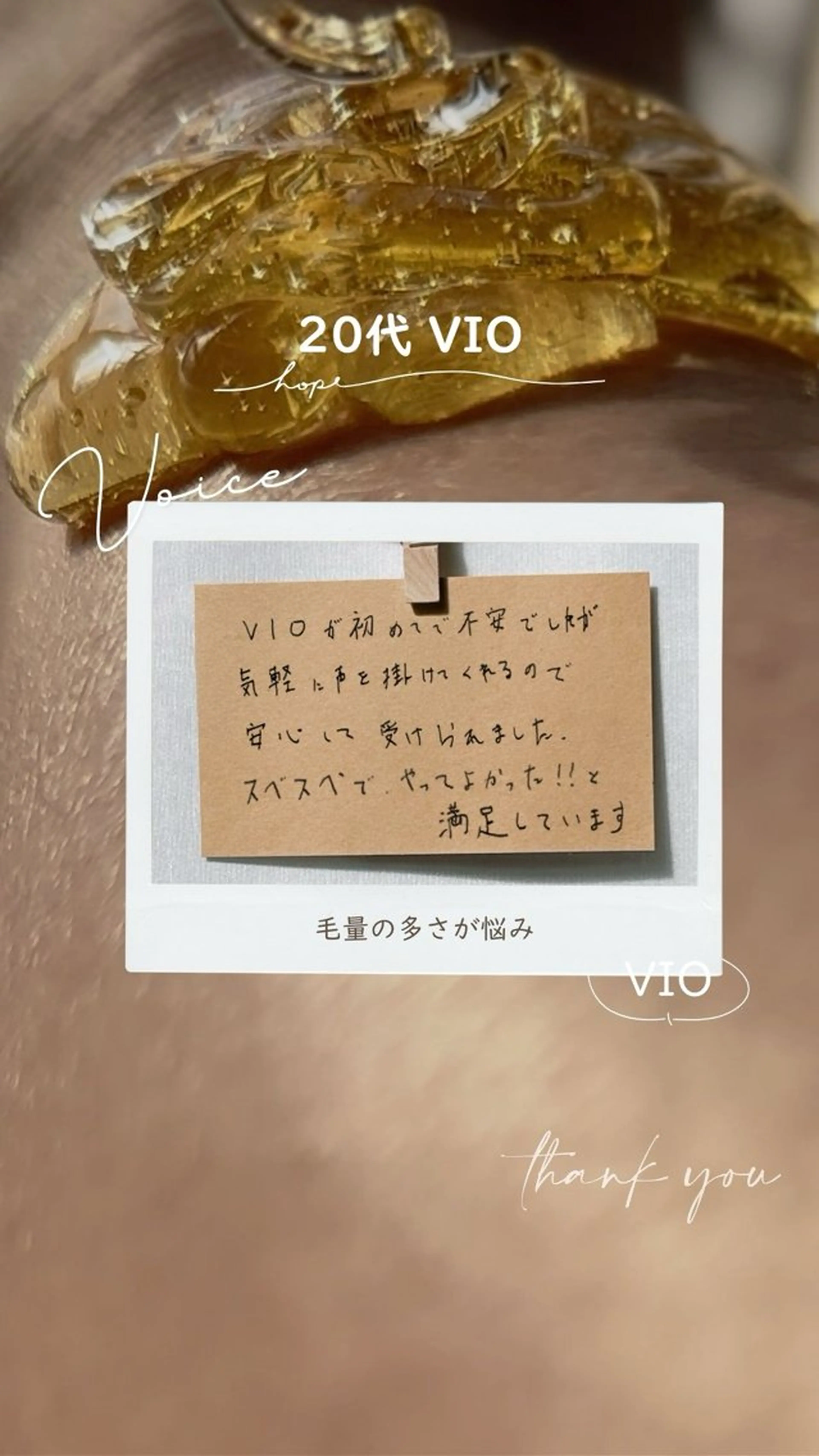 Hitomi シュガーリング豊橋のその他イメージ