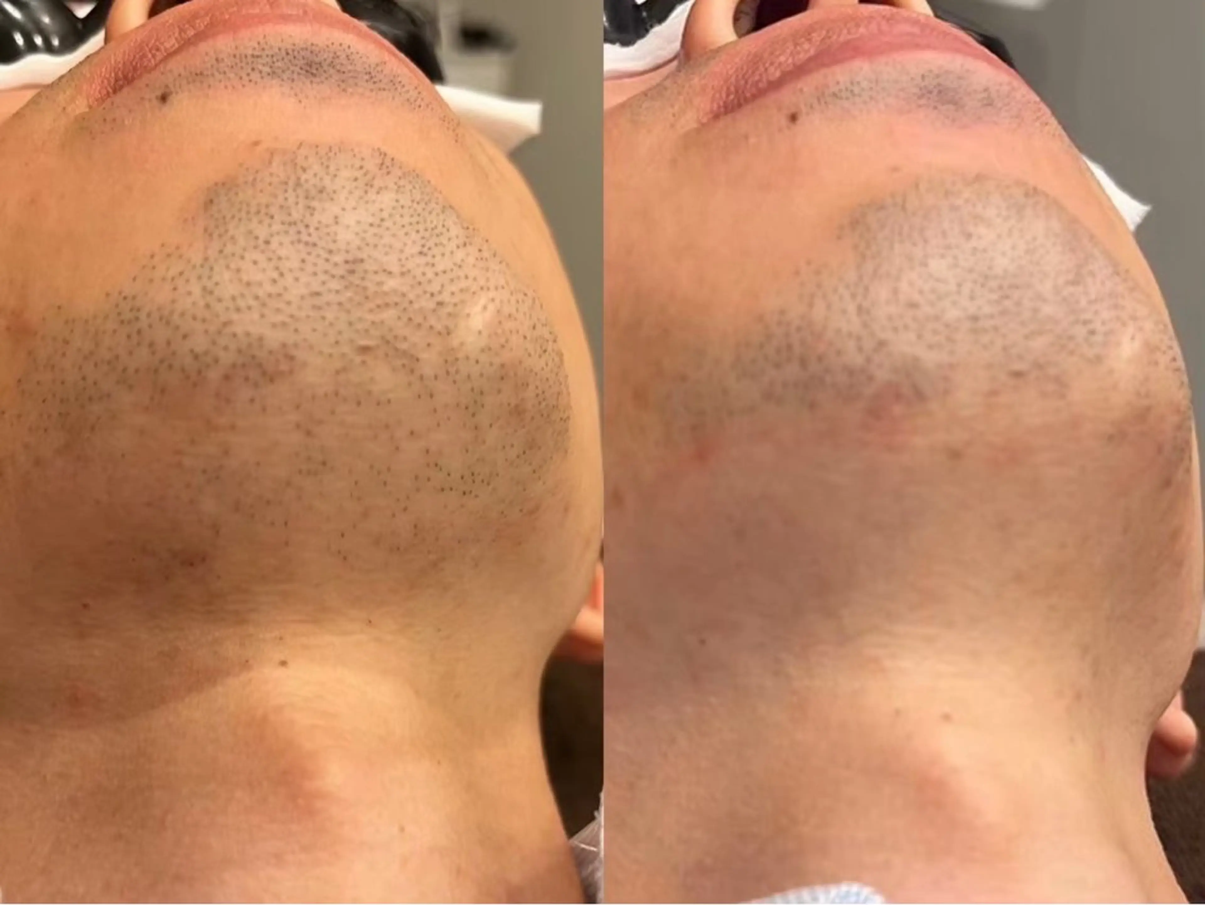 MINOA 井上🌷のエステ・リラクイメージ