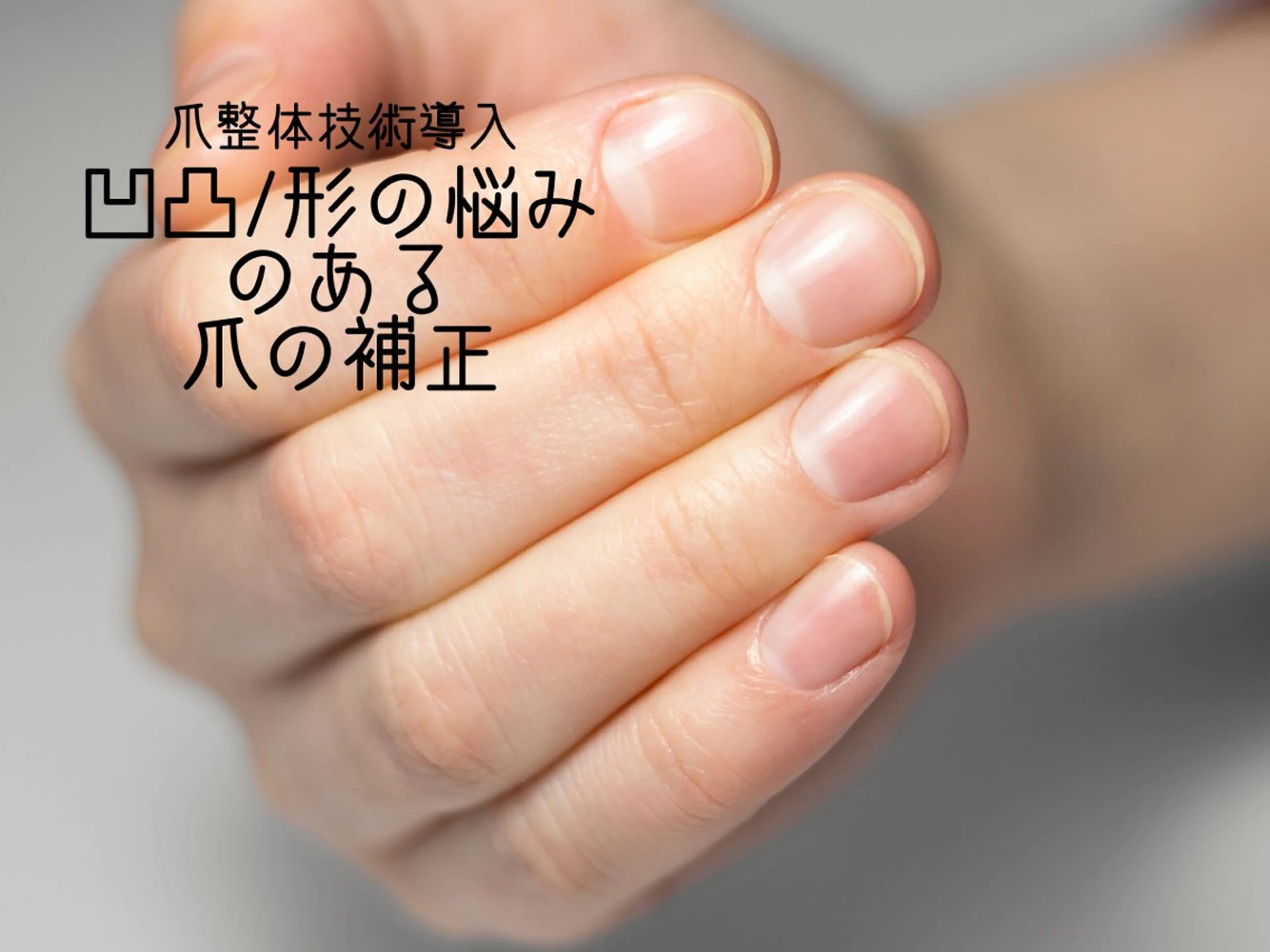 【ハンド】凹凸/形の悩みのある爪の補正/クリアorマットの写真