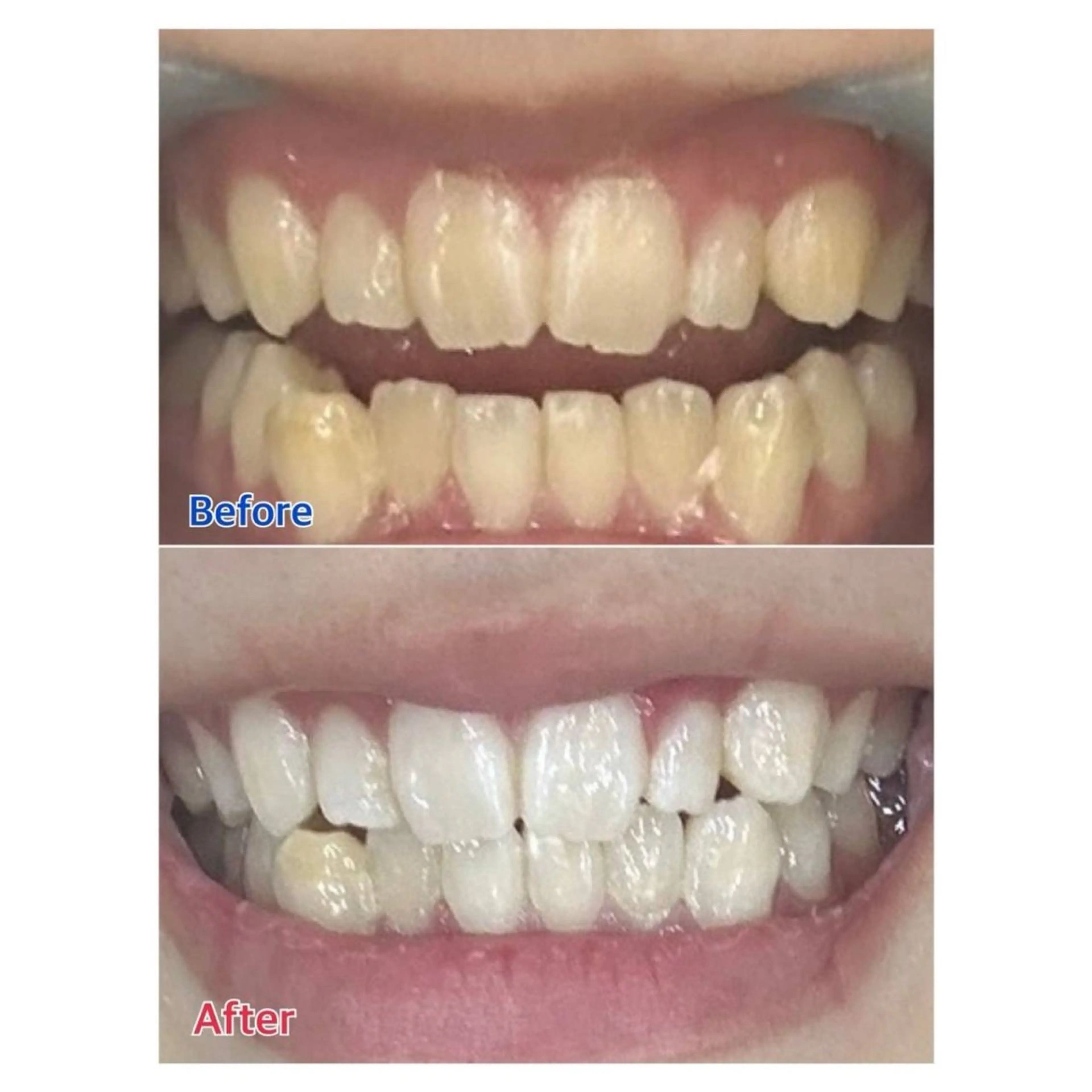 Melty 輝のその他イメージ