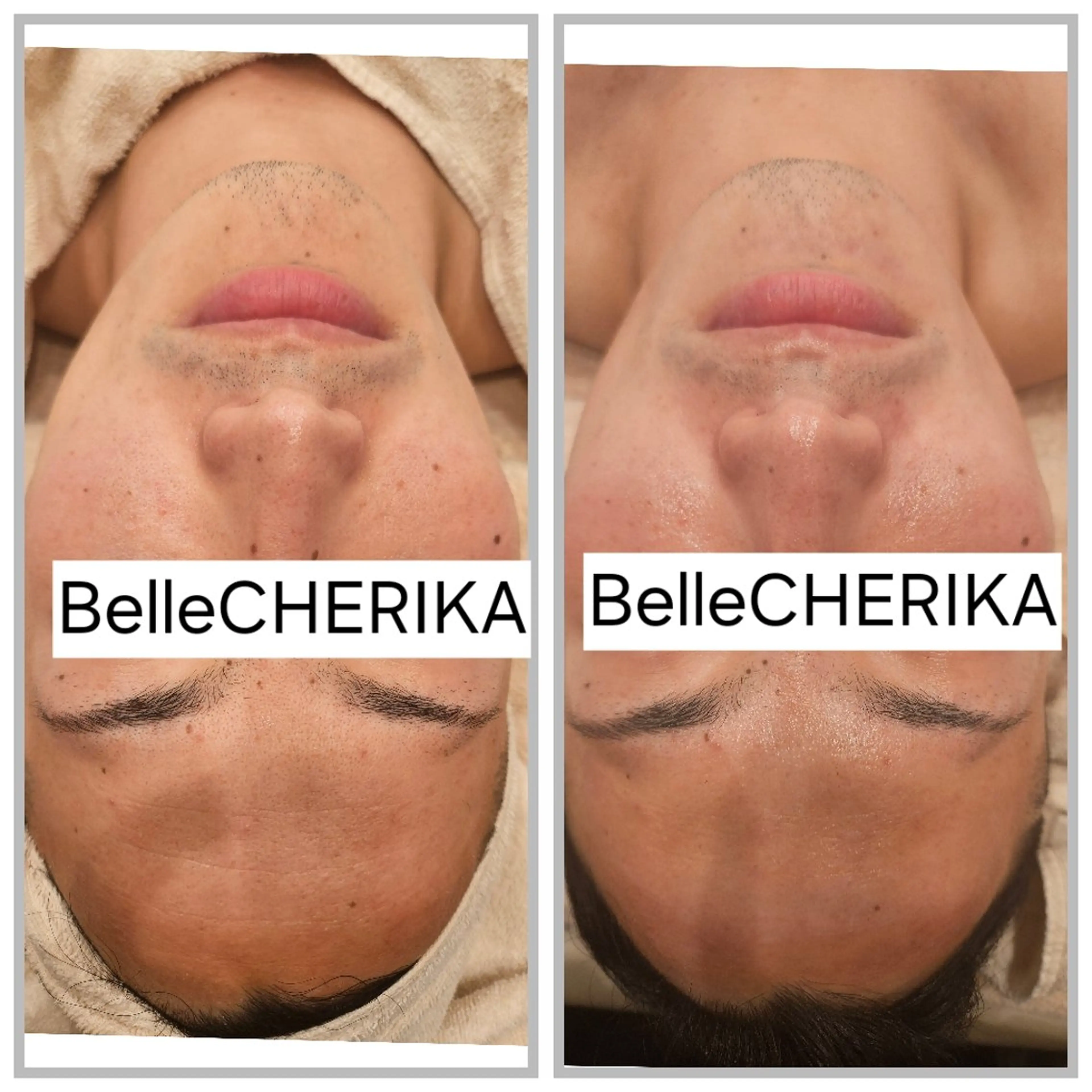 エステ ベル チェリカ 三城のエステ・リラクイメージ