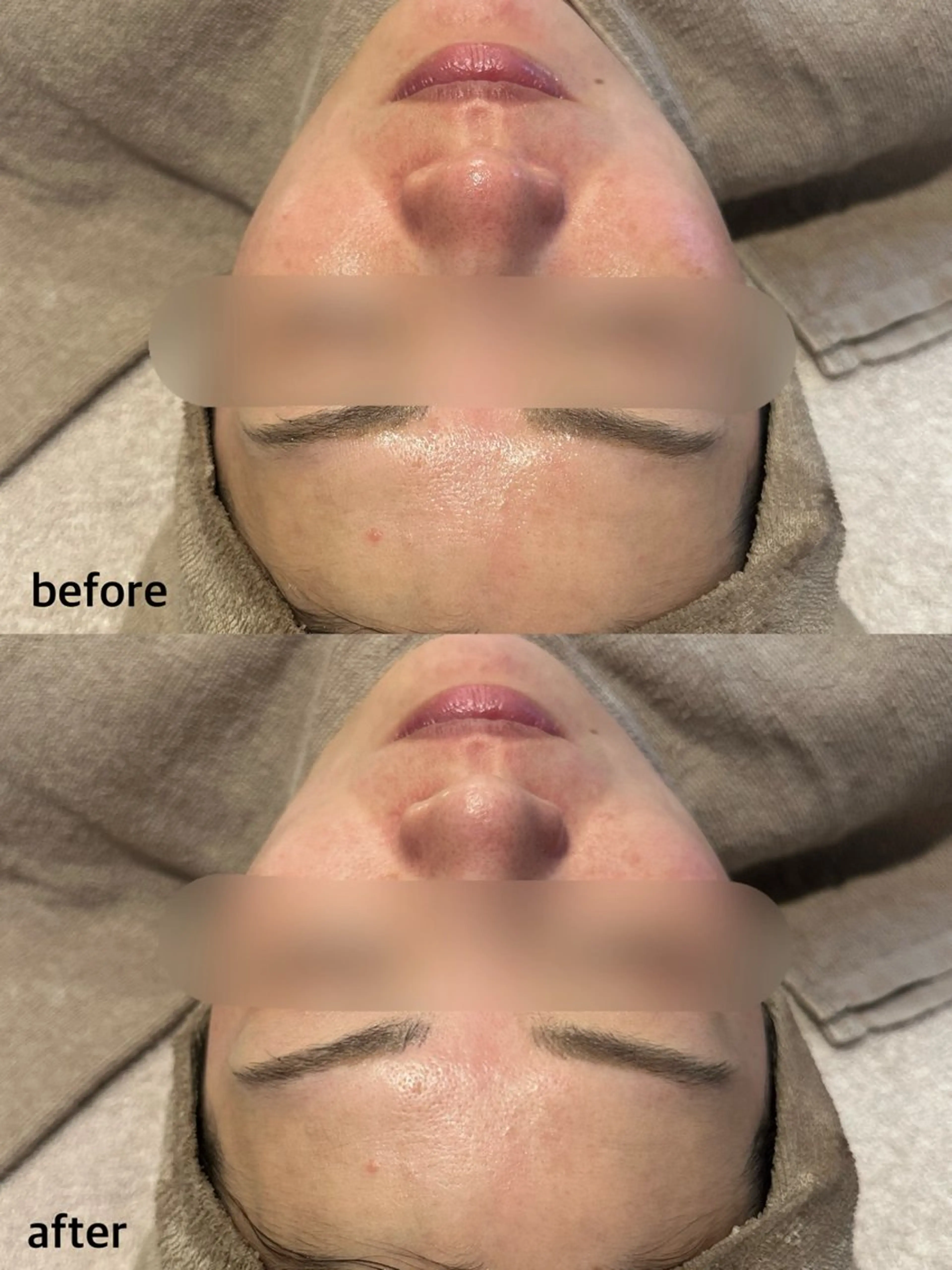 エステ Lassy aoiのマツエク・マツパデザイン