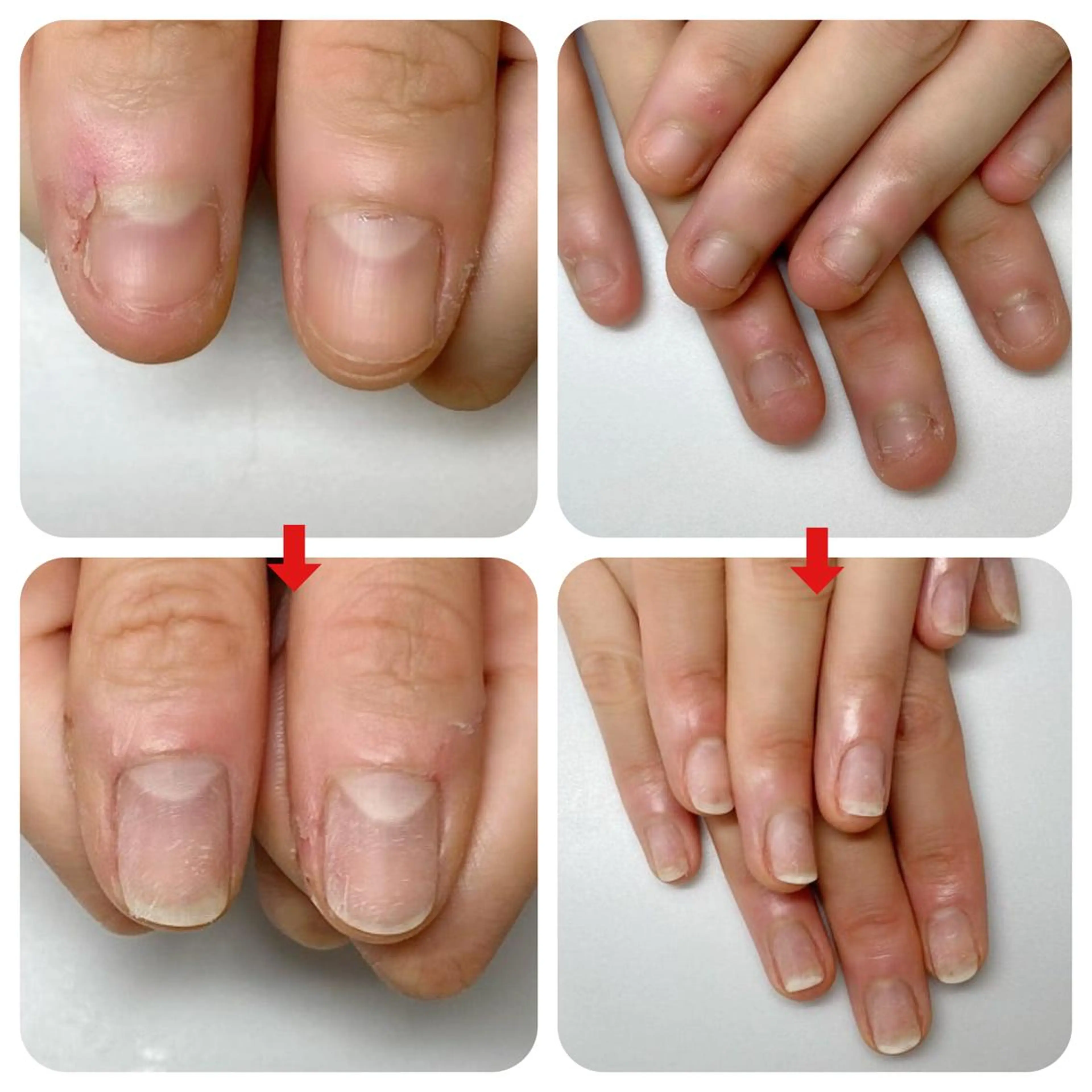 ネイル ネイルサロン アリュームのネイルデザイン