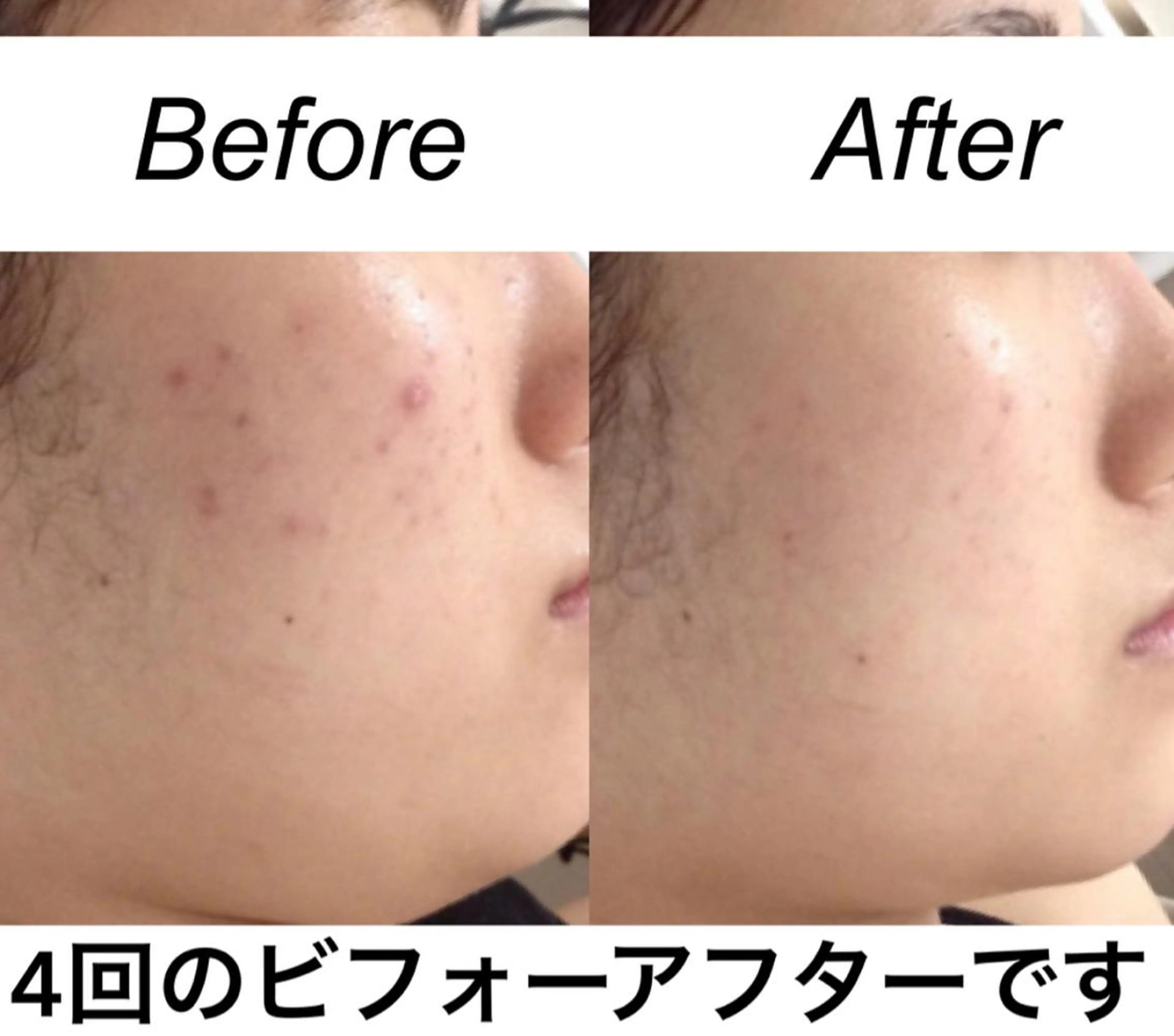 ミディアム カラー パーマ ヘアアレンジ キッズ ネイル マツエク・マツパ エステ リラク 都度払い肌質改善 &脱毛Blancheのエステ・リラクイメージ