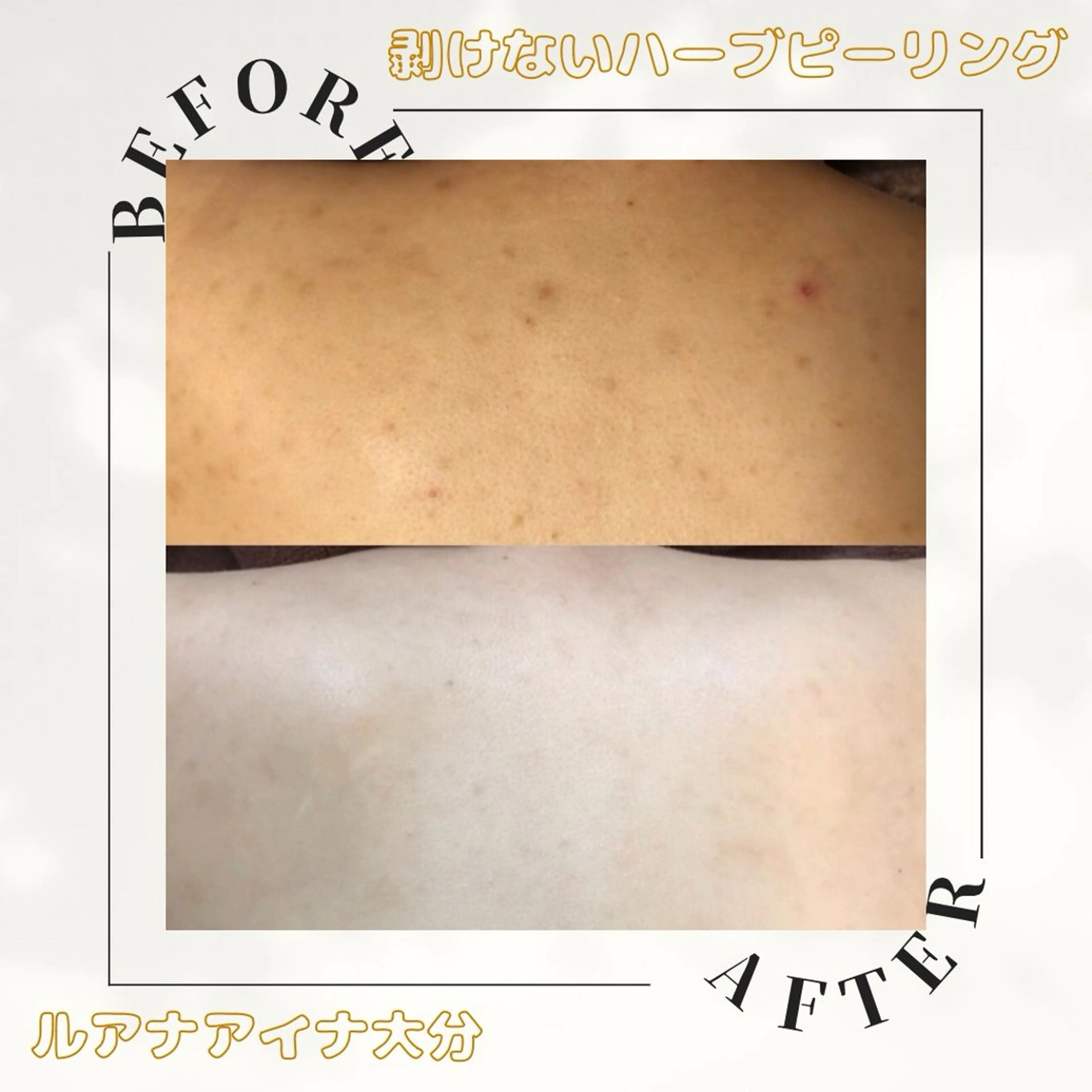 ルアナアイナ 大分のエステ・リラクイメージ