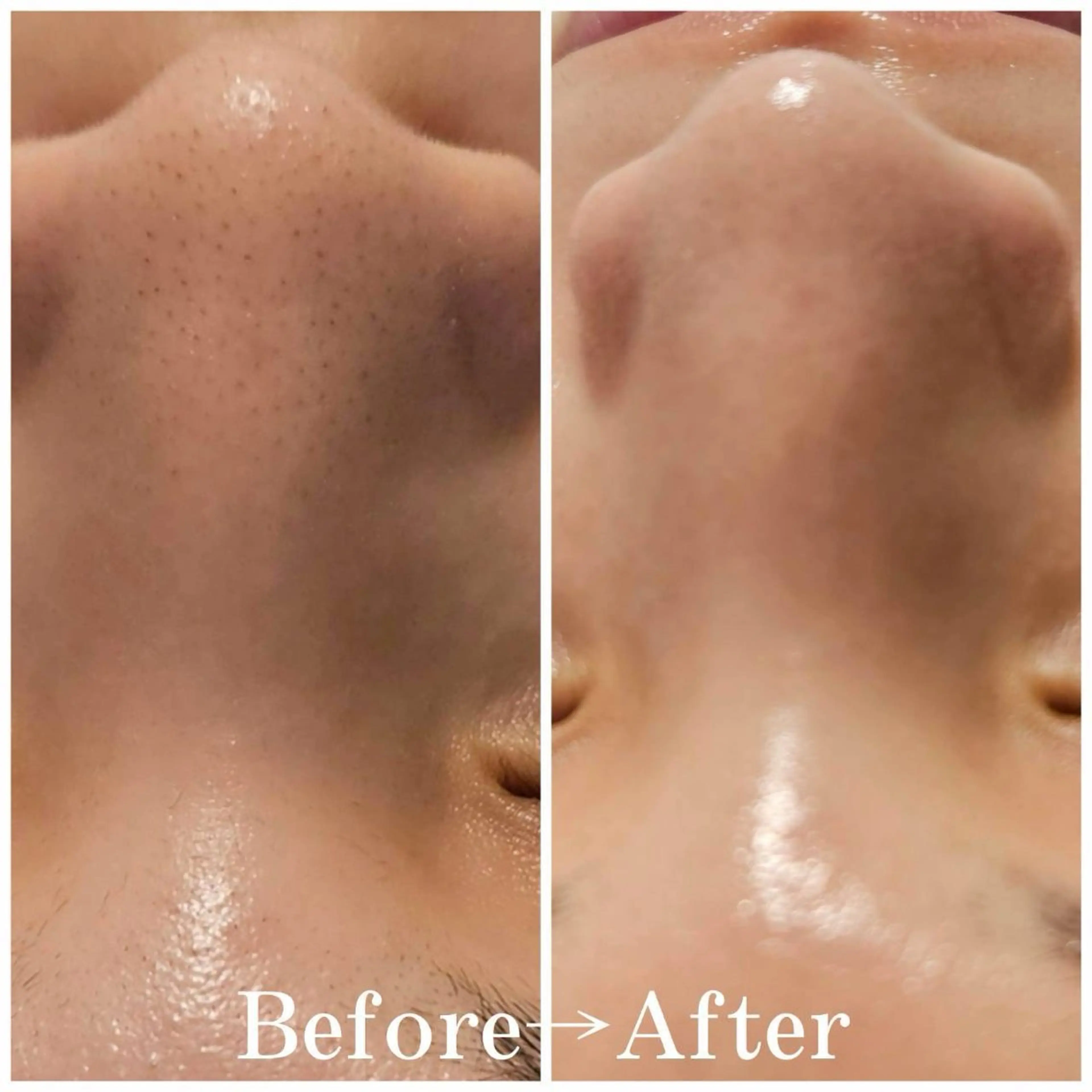 【鎮静・土台ケア】HAAB REPROリカバリートリートメントの写真