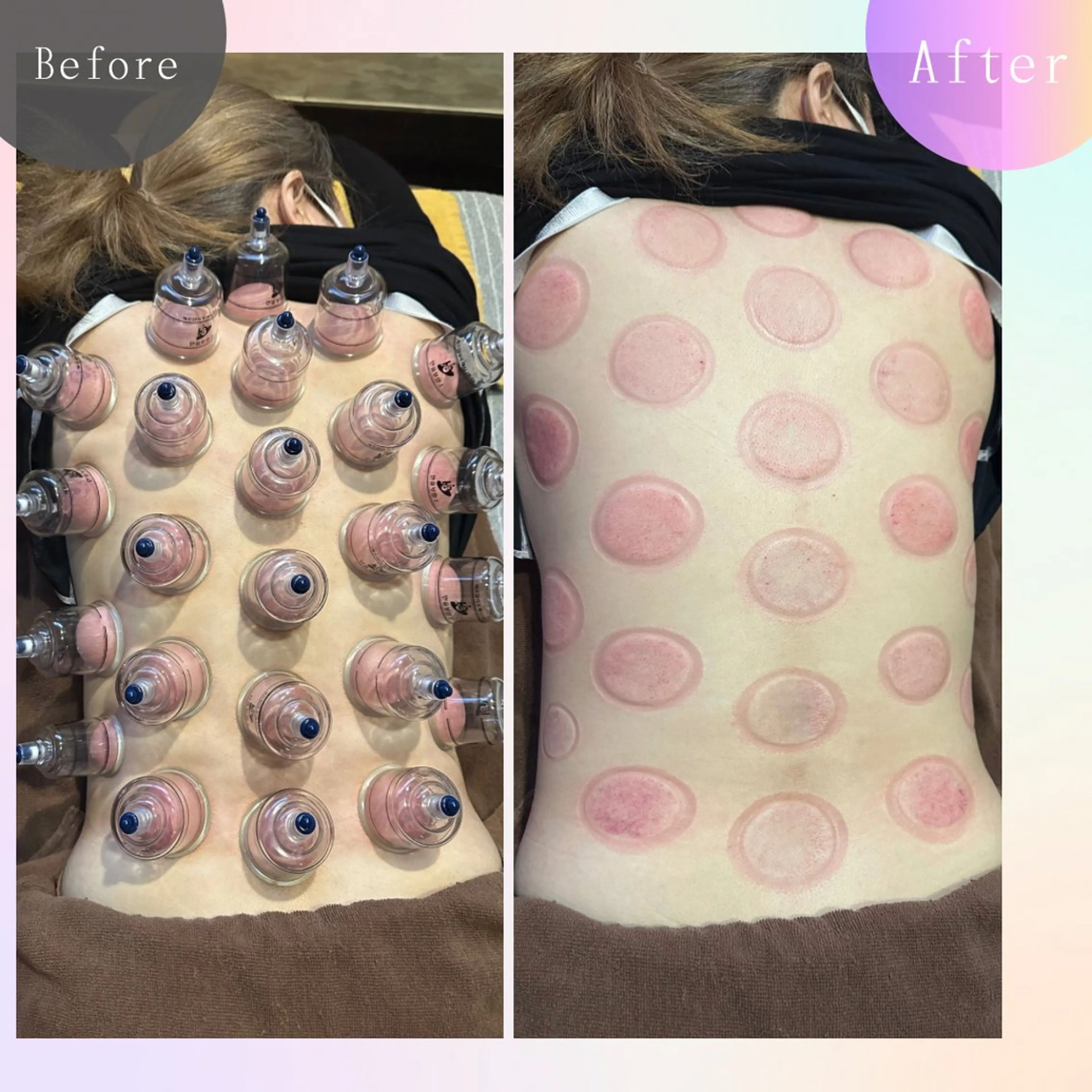 その他 鍼灸院楽々館所属・宇田 碧のエステ・リラクイメージ