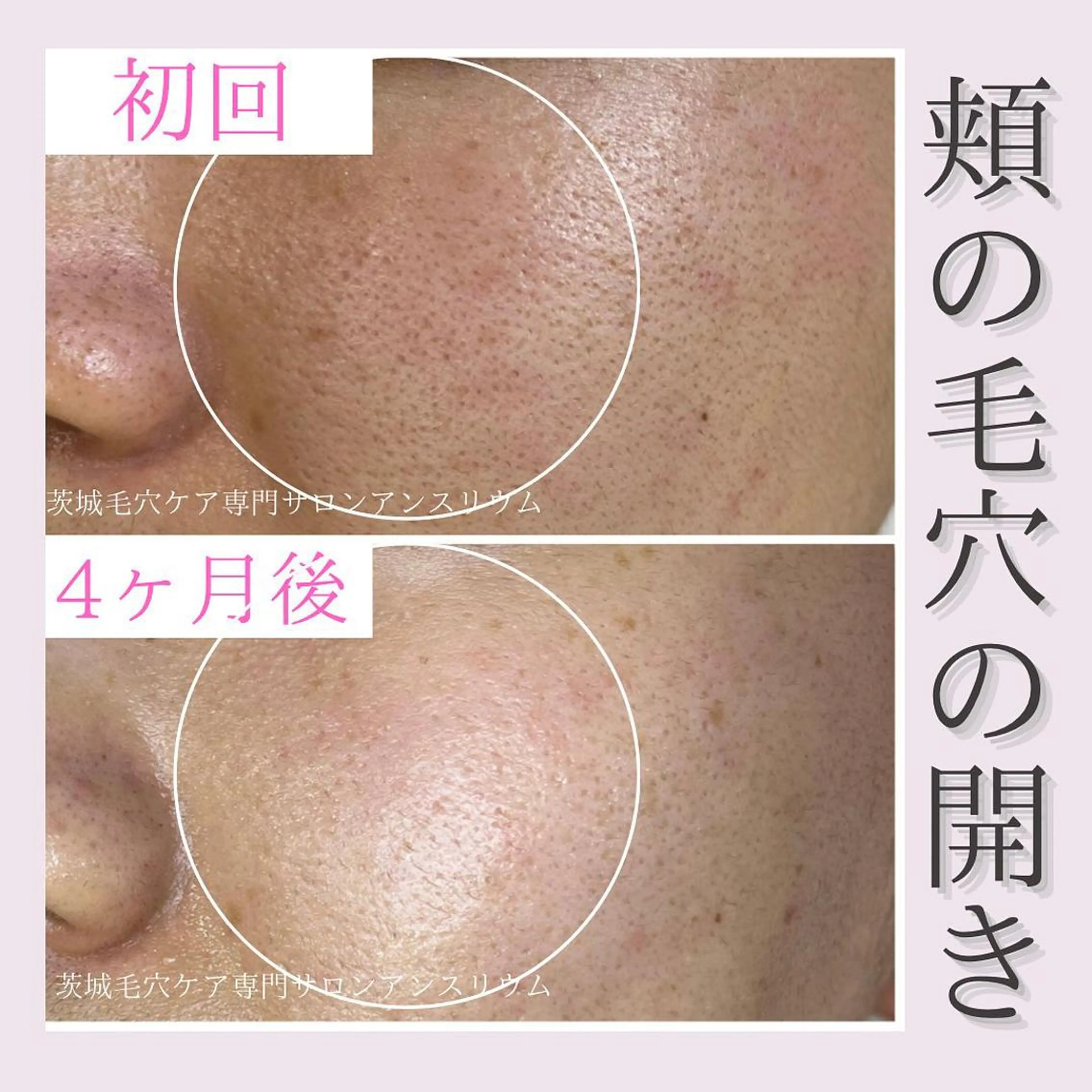 茨城土浦 つくば毛穴 ケア専門サロンのエステ・リラクイメージ