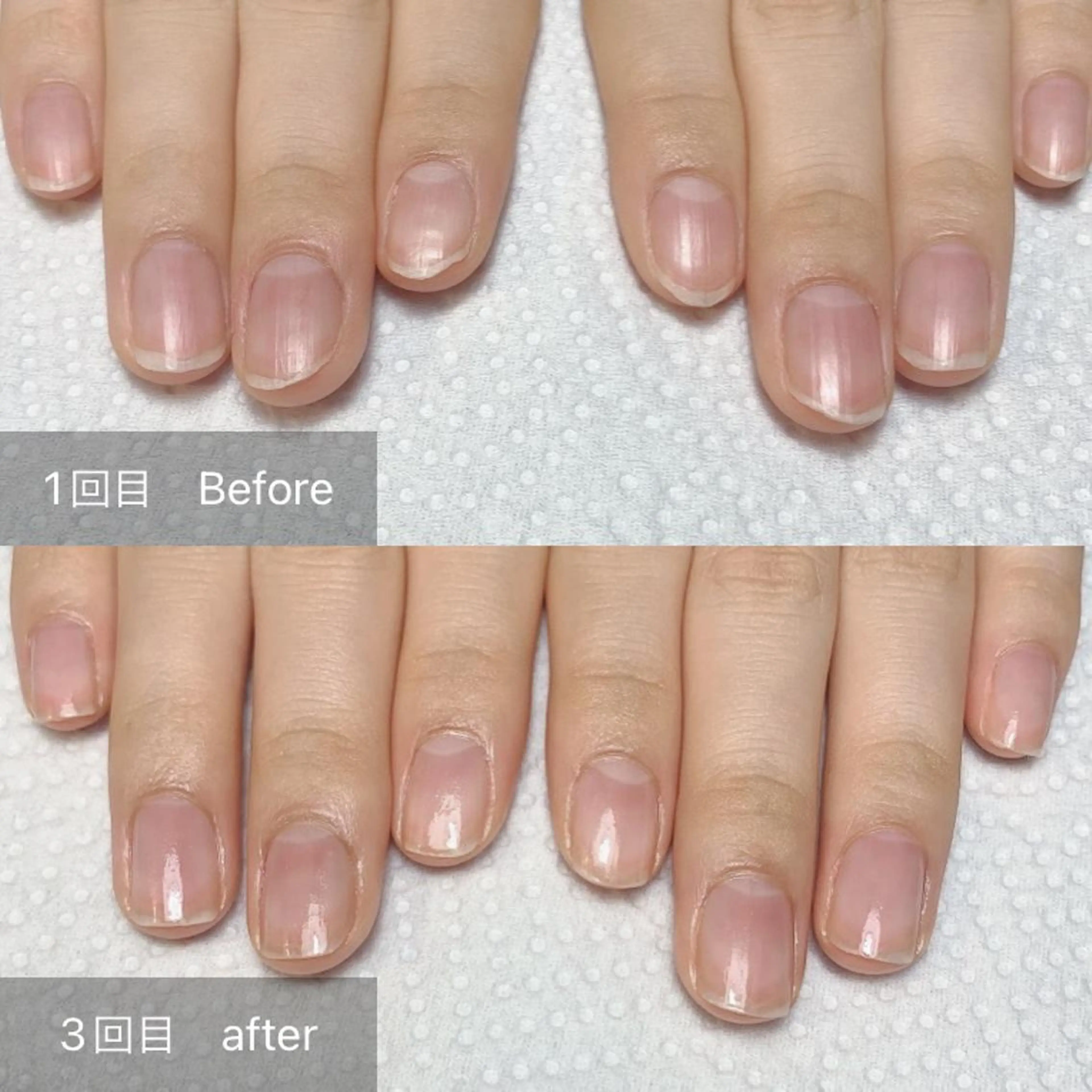 ネイル その他(ネイル) 木村 千晴のネイルデザイン