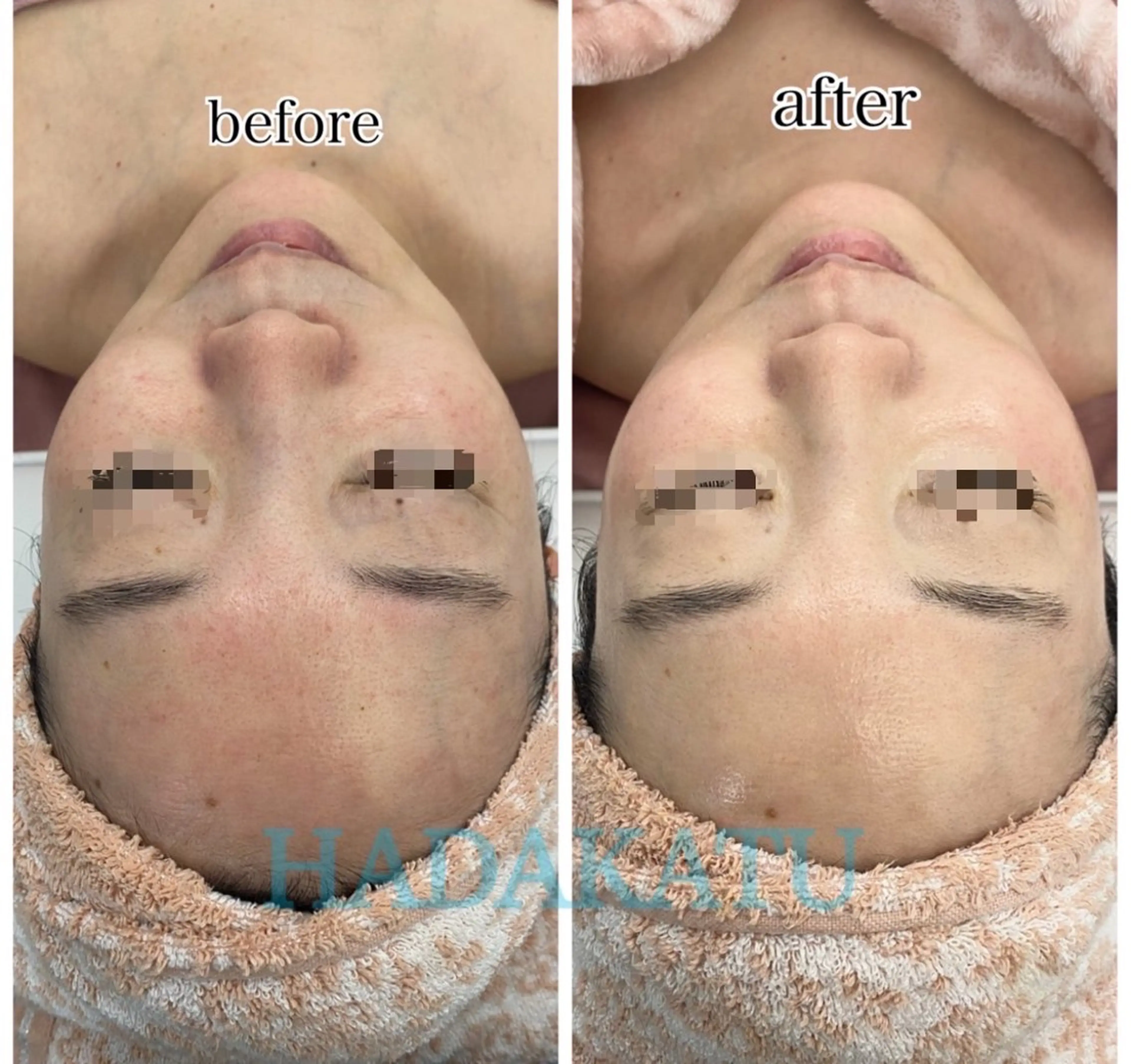 エステ 総合エステサロン 肌活のエステ・リラクイメージ