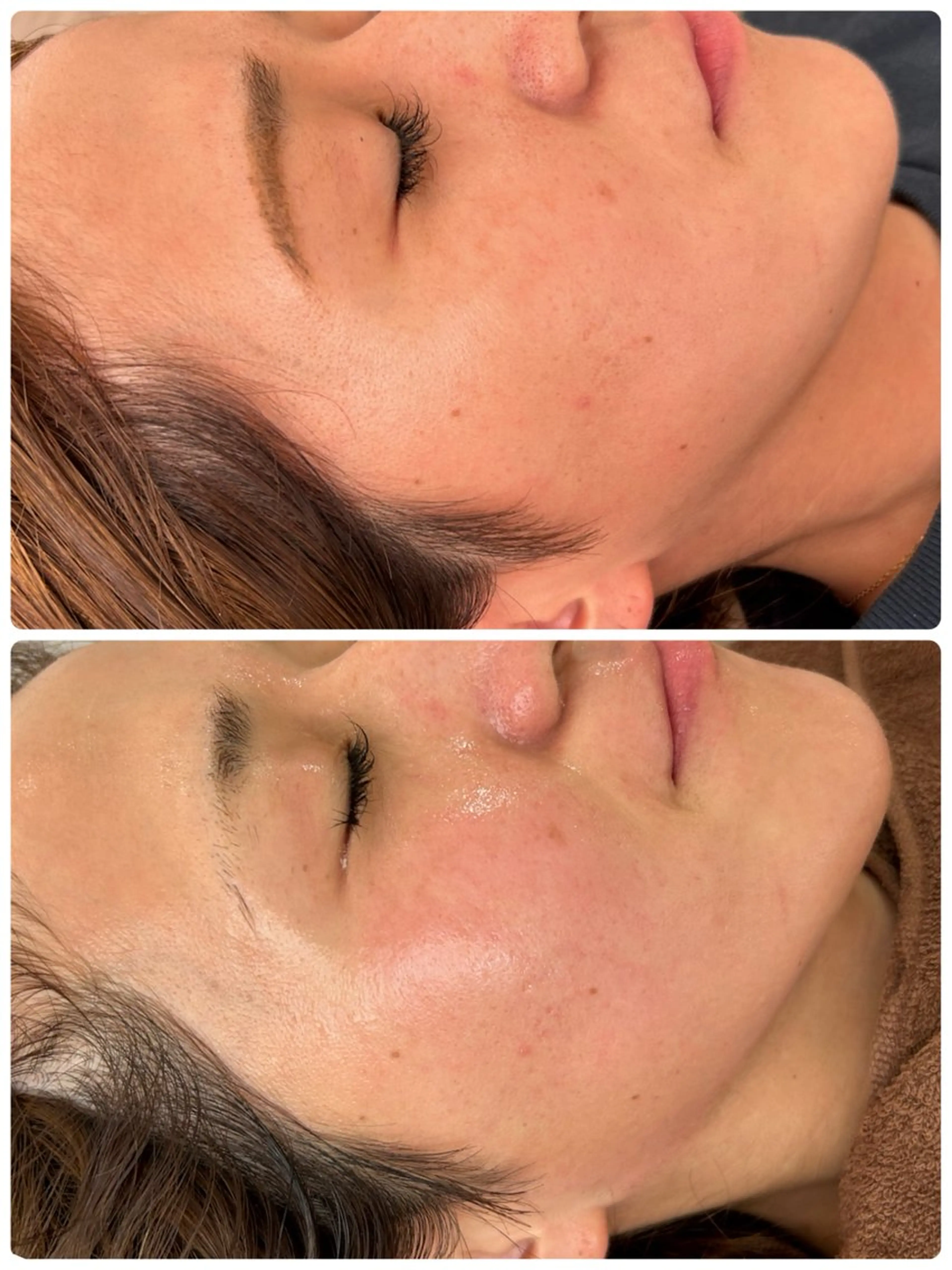 エステ 産毛角質ケア/艶肌 フェイシャルワックスのエステ・リラクイメージ