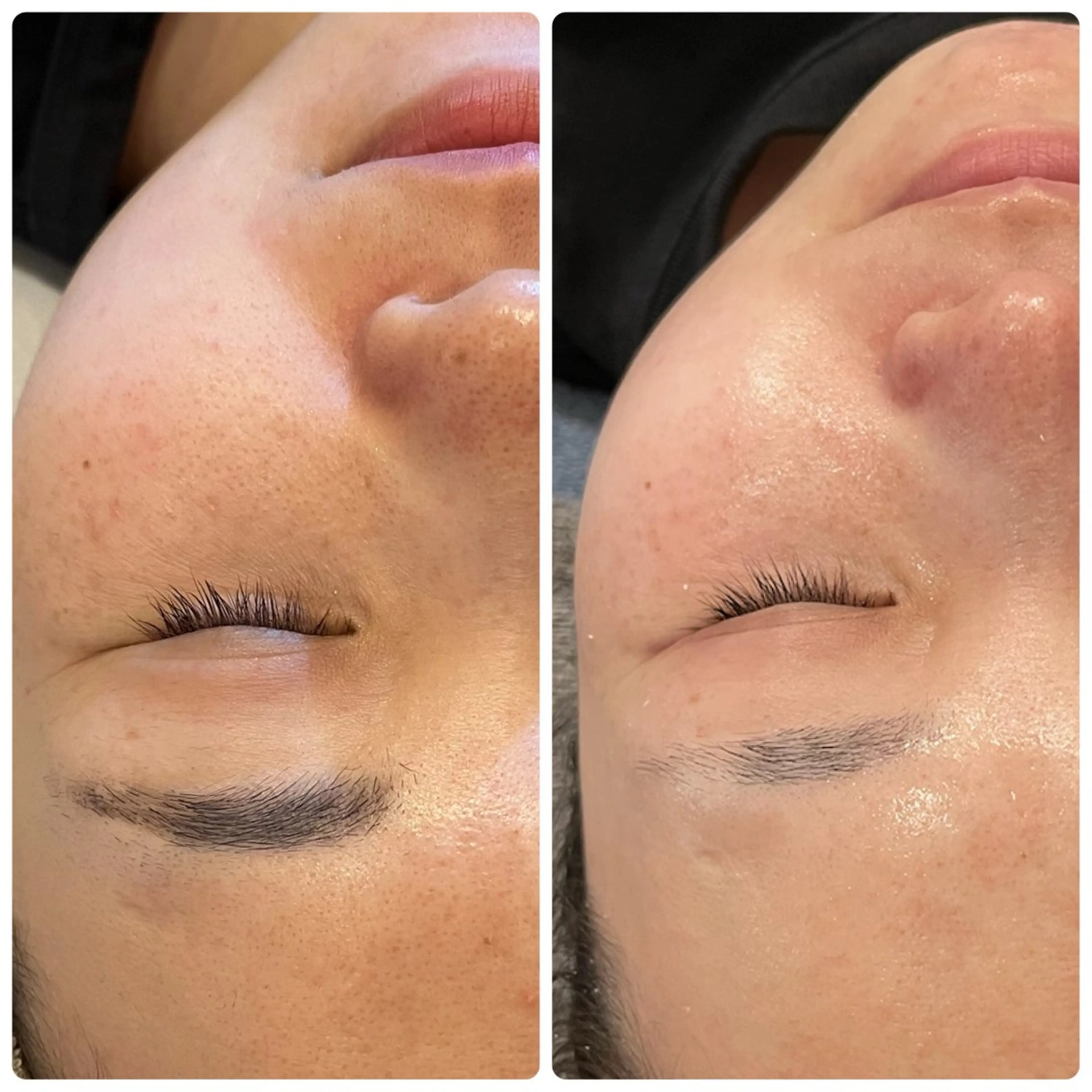 エステ yellow💛【 脱毛&フェイシャル】のエステ・リラクイメージ