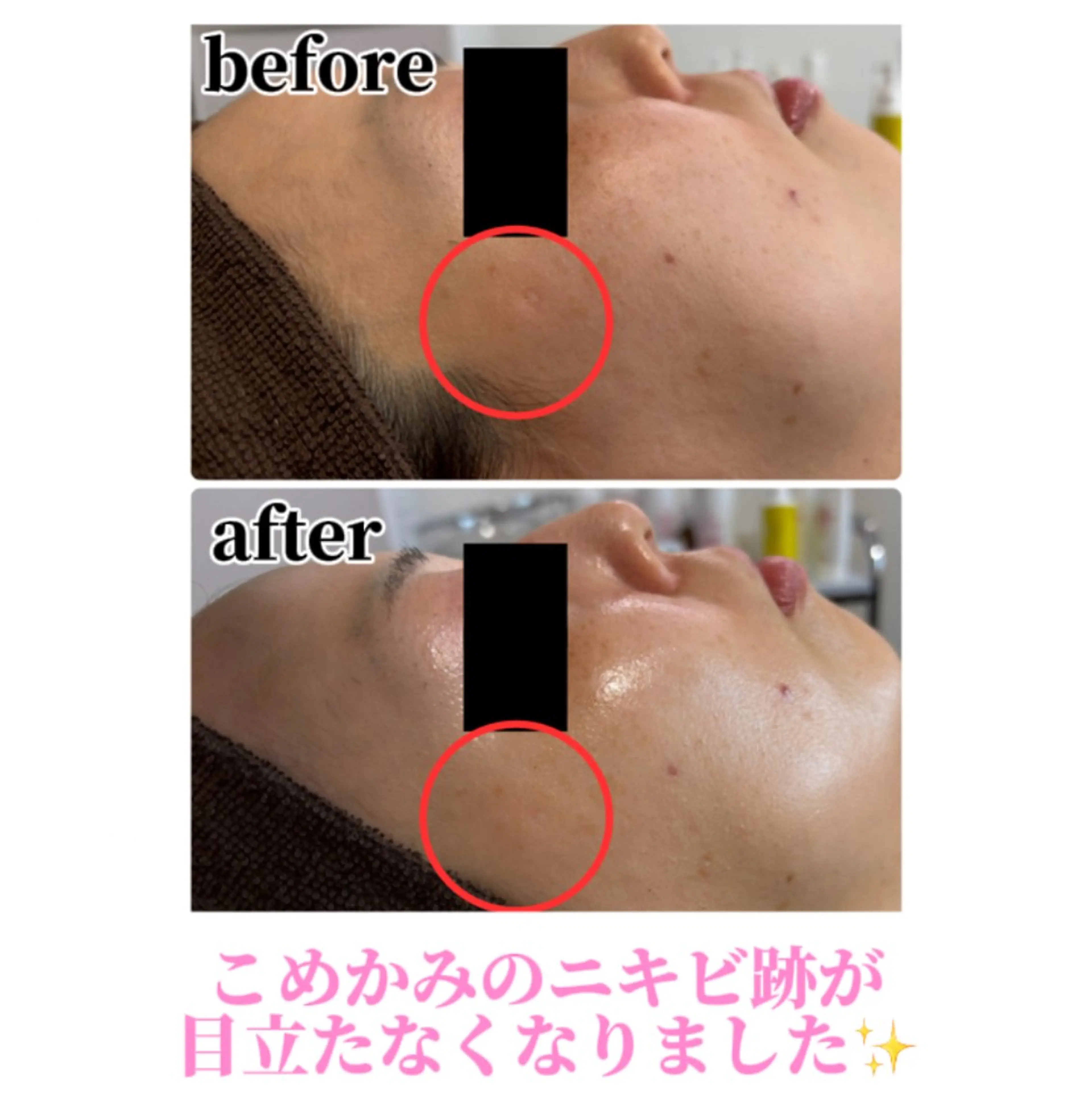 エステ Beauty salonBellのエステ・リラクイメージ