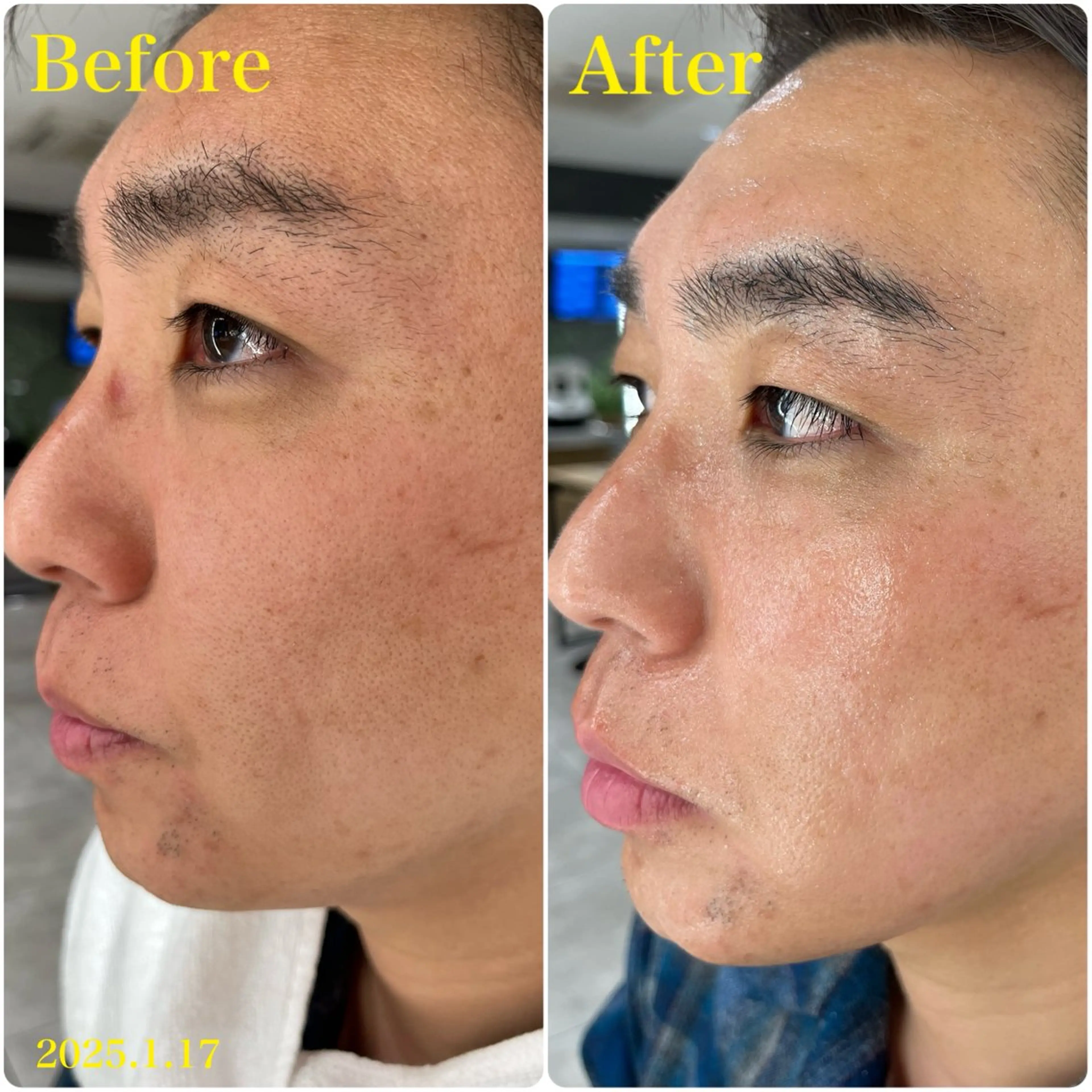 エステ DeCoLé Beauty所属・艶肌/敏感肌/若さ/ ボディ痩身🌿のエステ・リラクイメージ