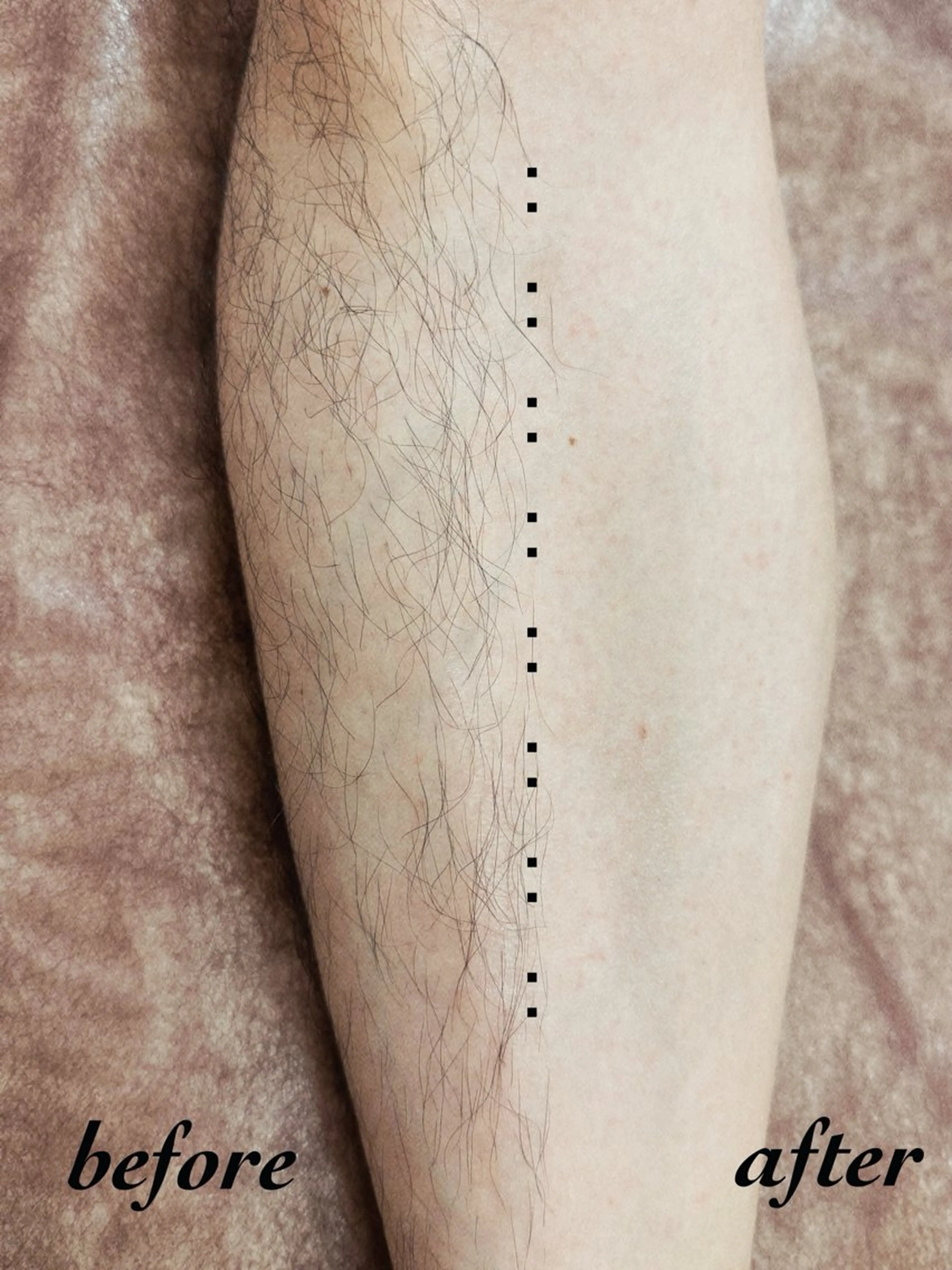 メンズ 脱毛サロン CREVIOのエステ・リラクイメージ