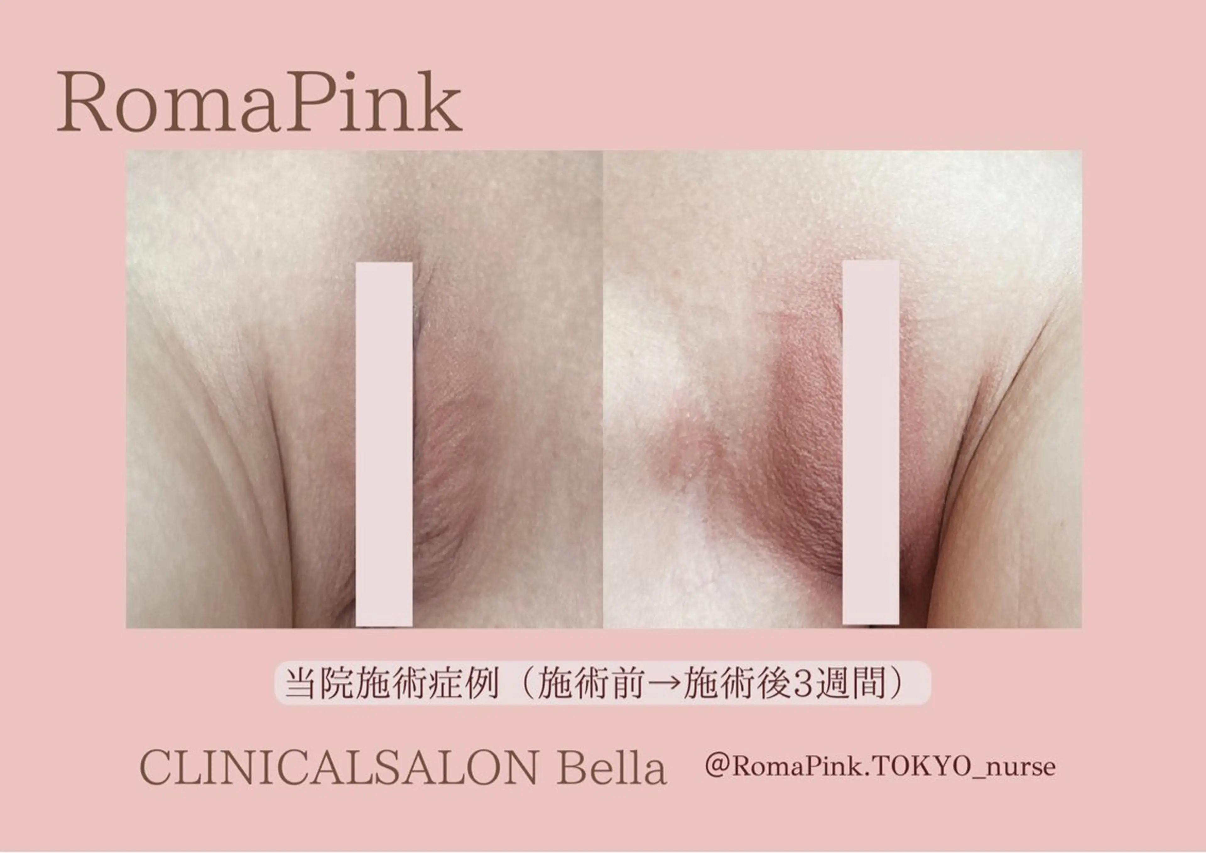 看護師 AYUIのエステ・リラクイメージ