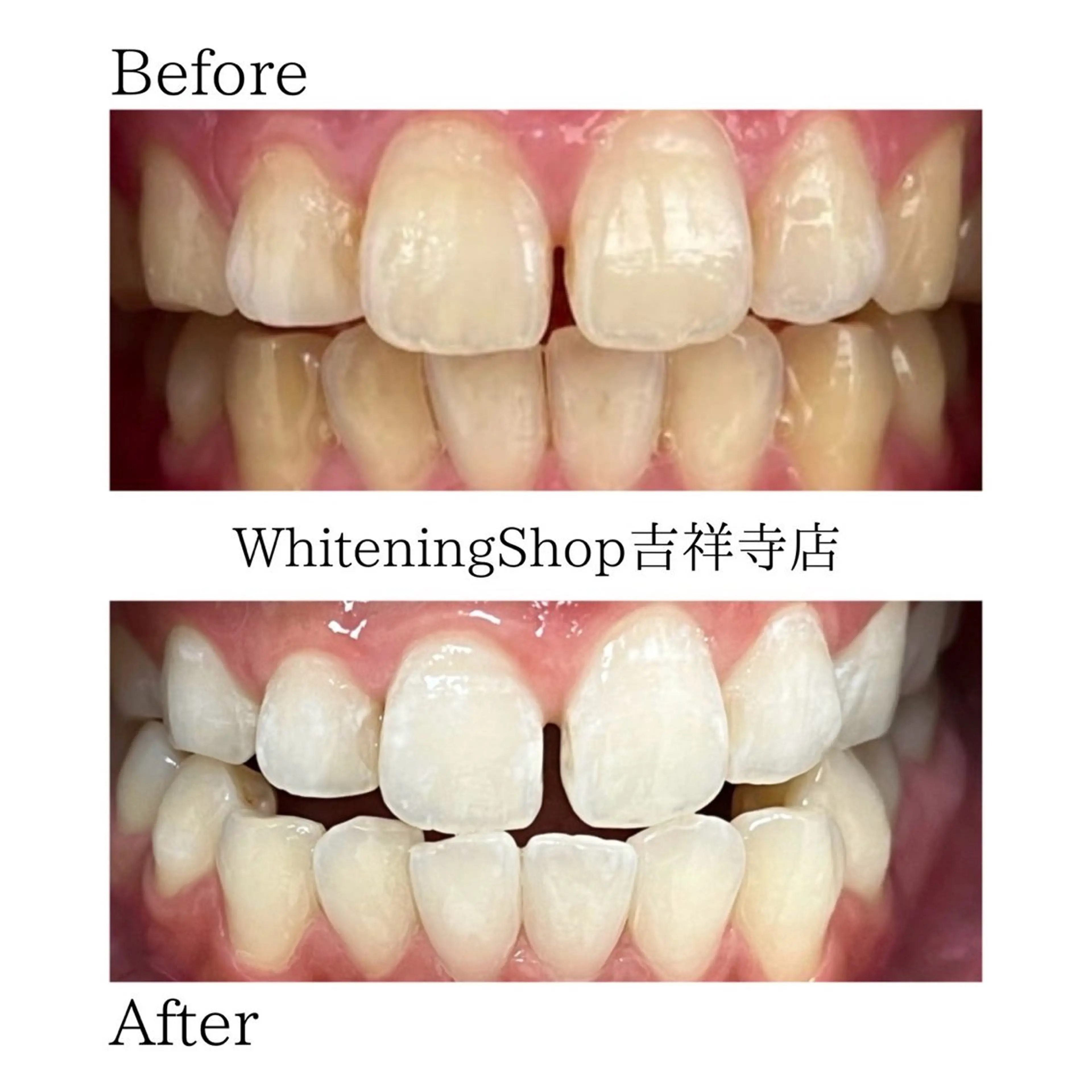 エステ リラク ホワイトニング ショップ吉祥寺店のエステ・リラクイメージ