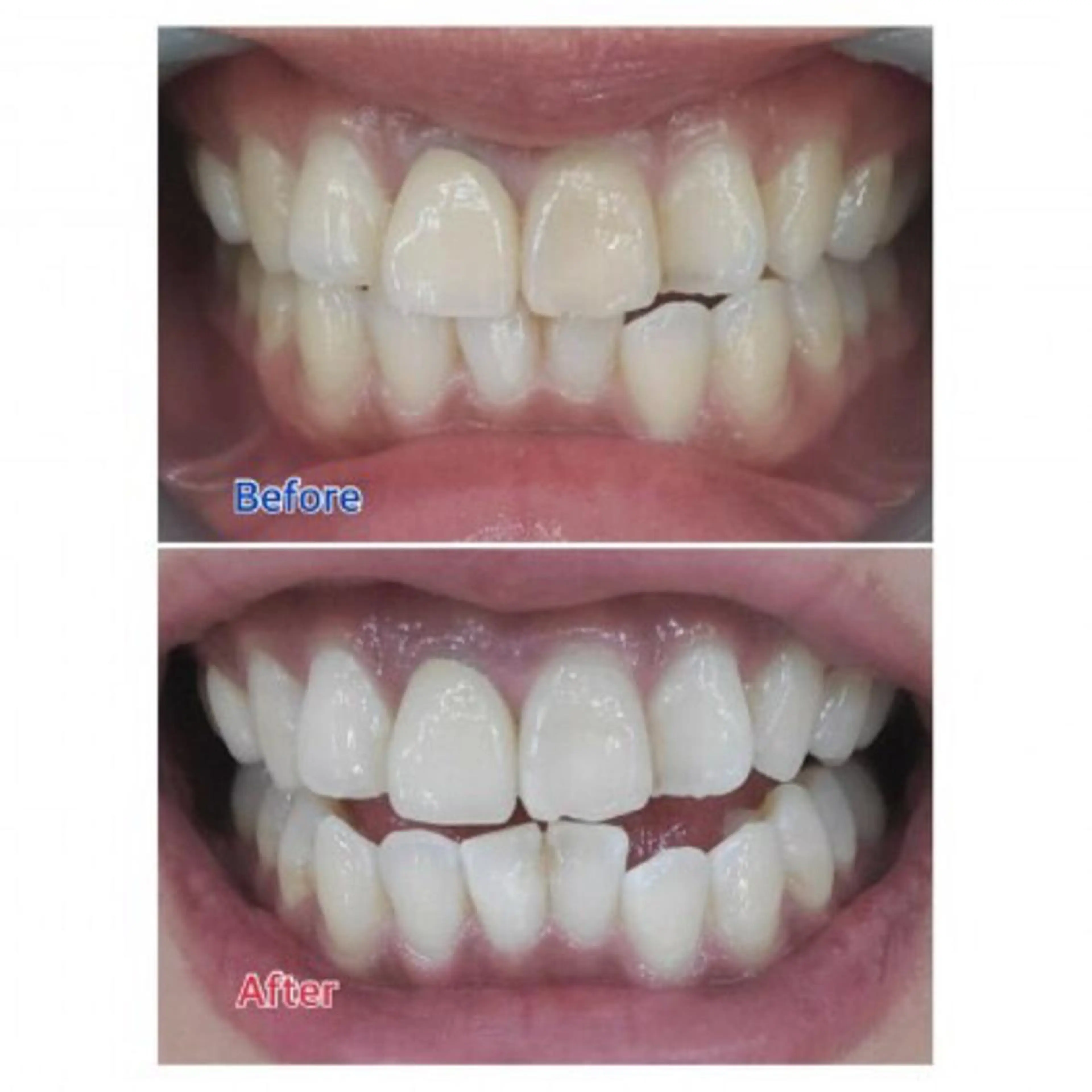 Ｍ渋谷 ホワイトニングのエステ・リラクイメージ