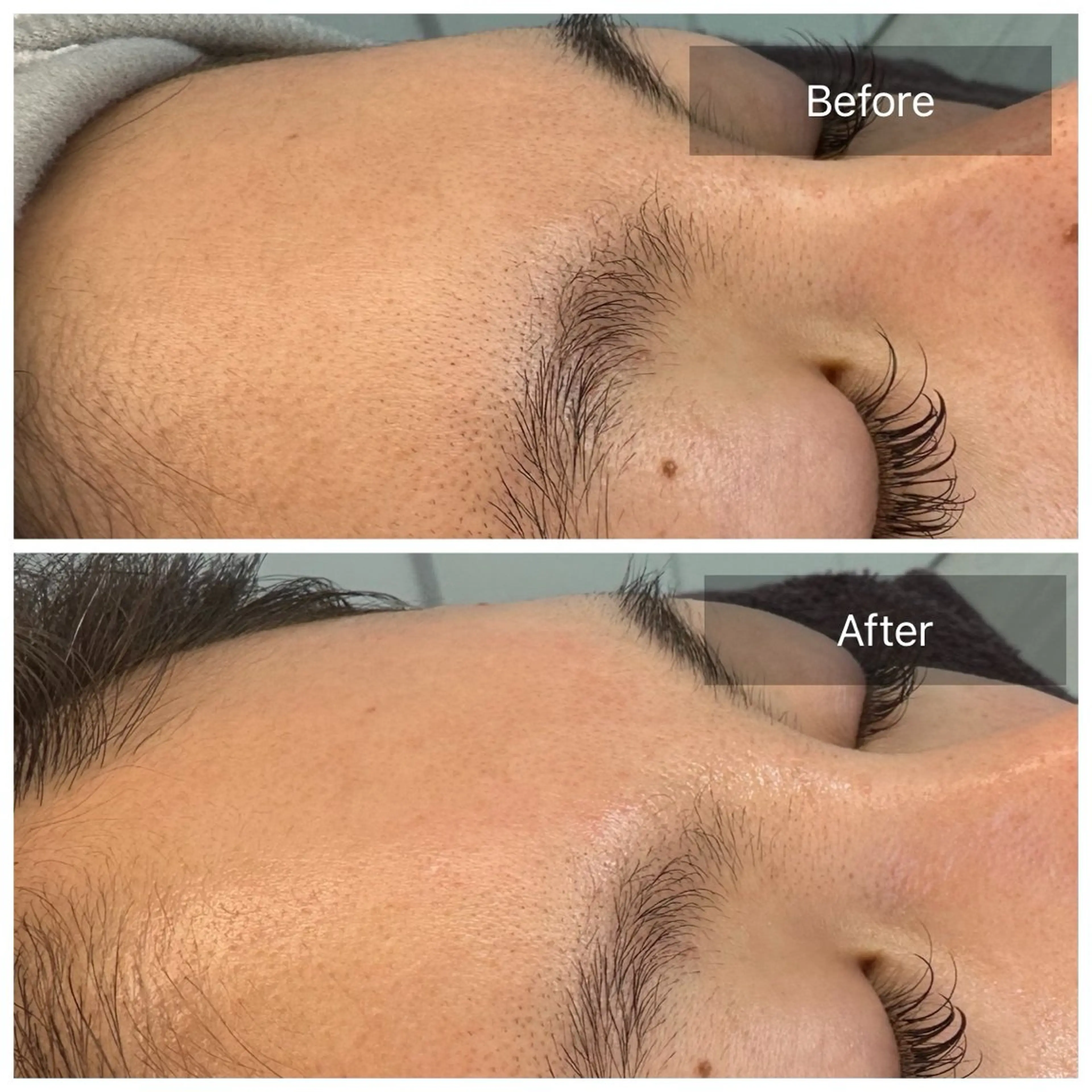 脱毛 トータルしみケア専門 NICA(ニカ)の眉毛・アイブロウイメージ