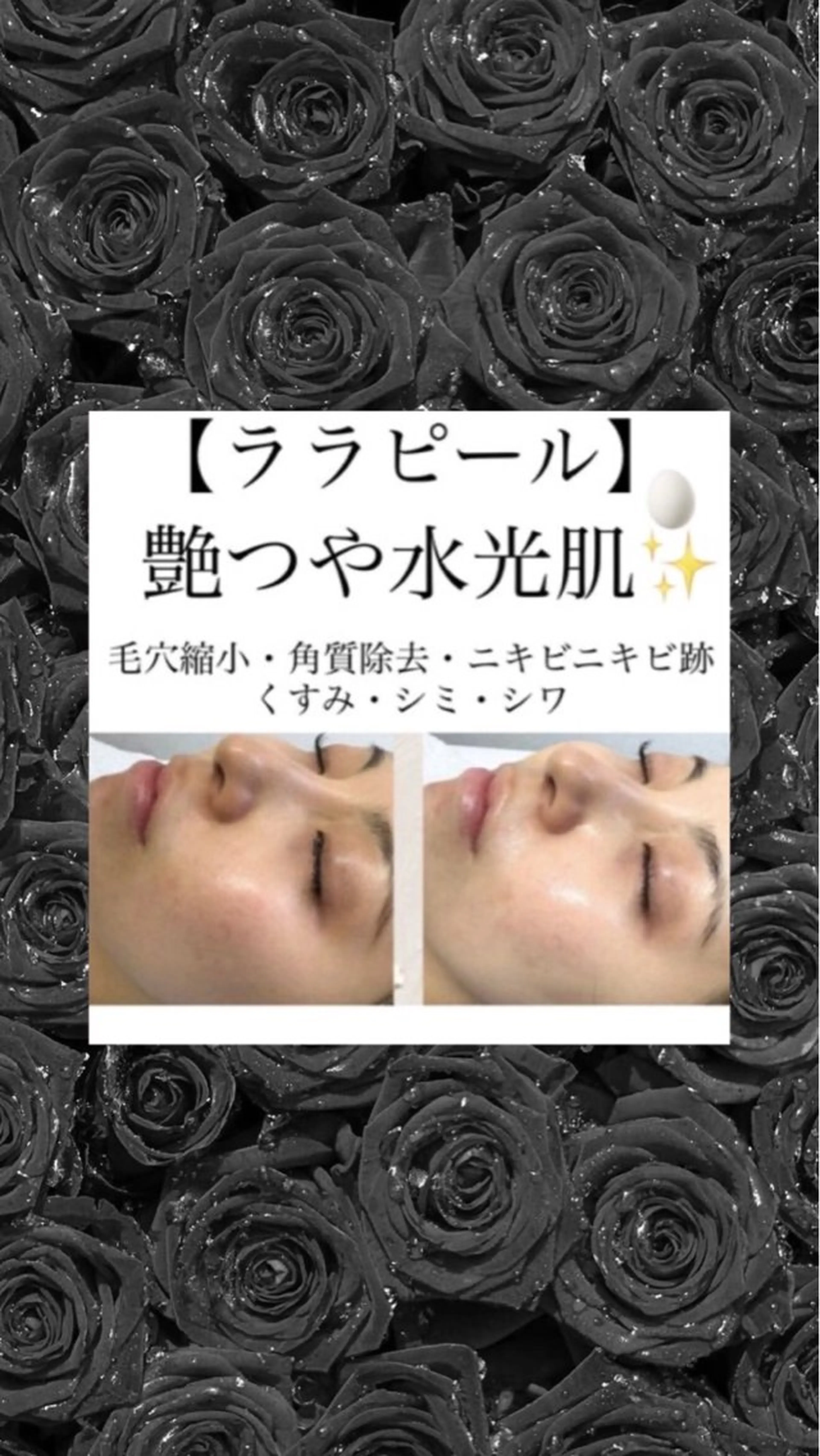 メディカルエステ マドンナのエステ・リラクイメージ