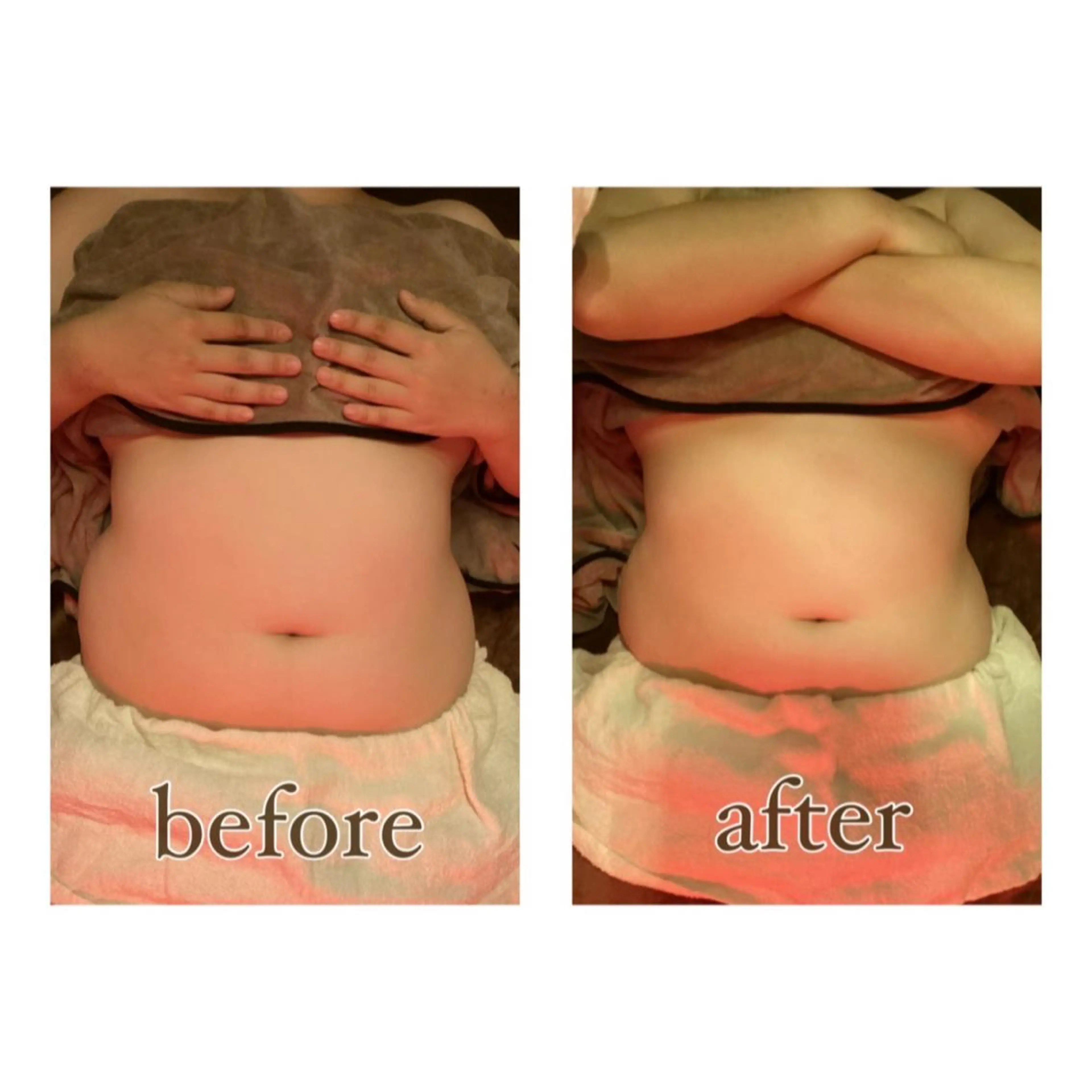 美腸専門 漢方よもぎ蒸しのエステ・リラクイメージ