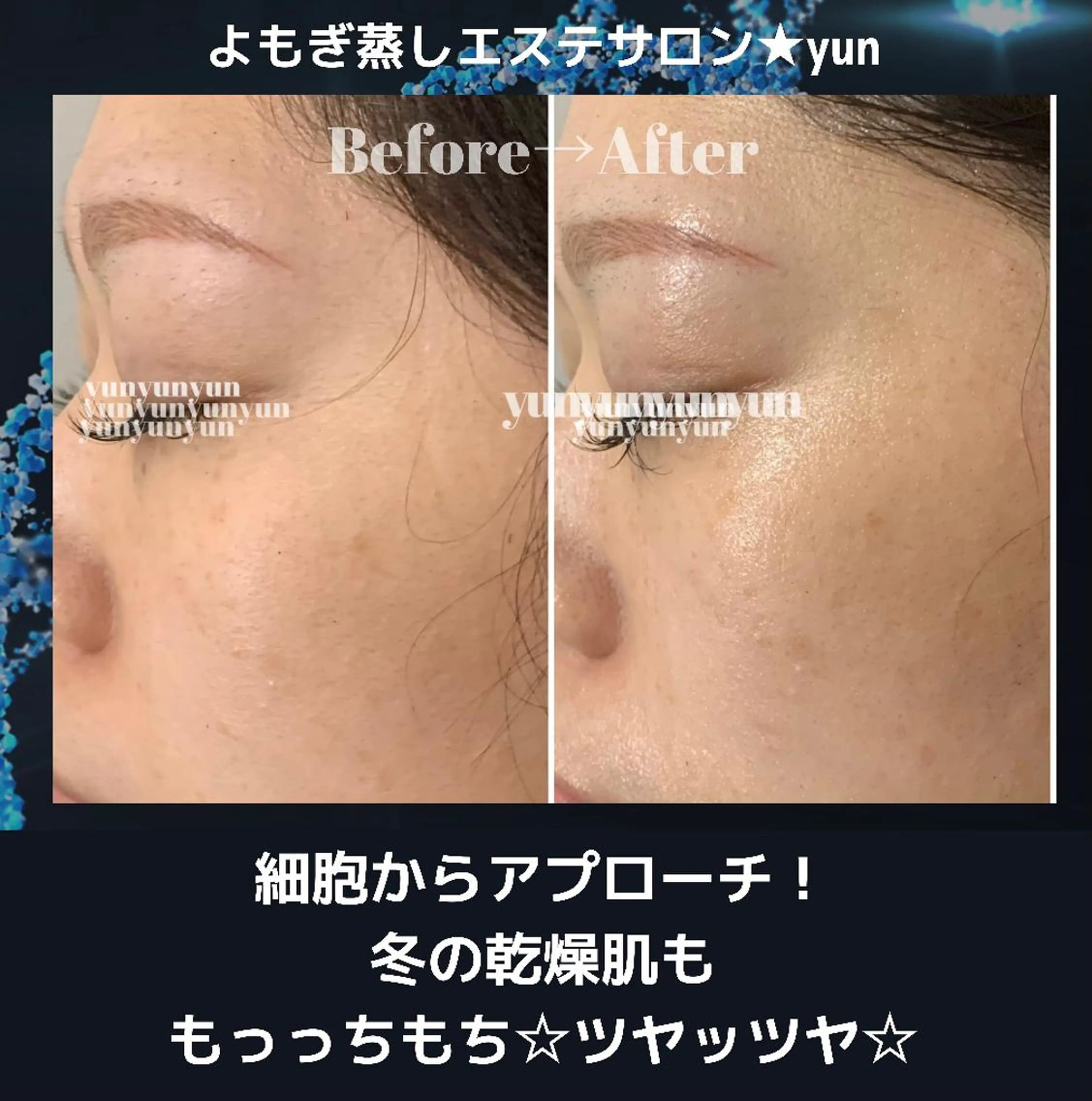 よもぎ蒸しサロン ゆんのエステ・リラクイメージ
